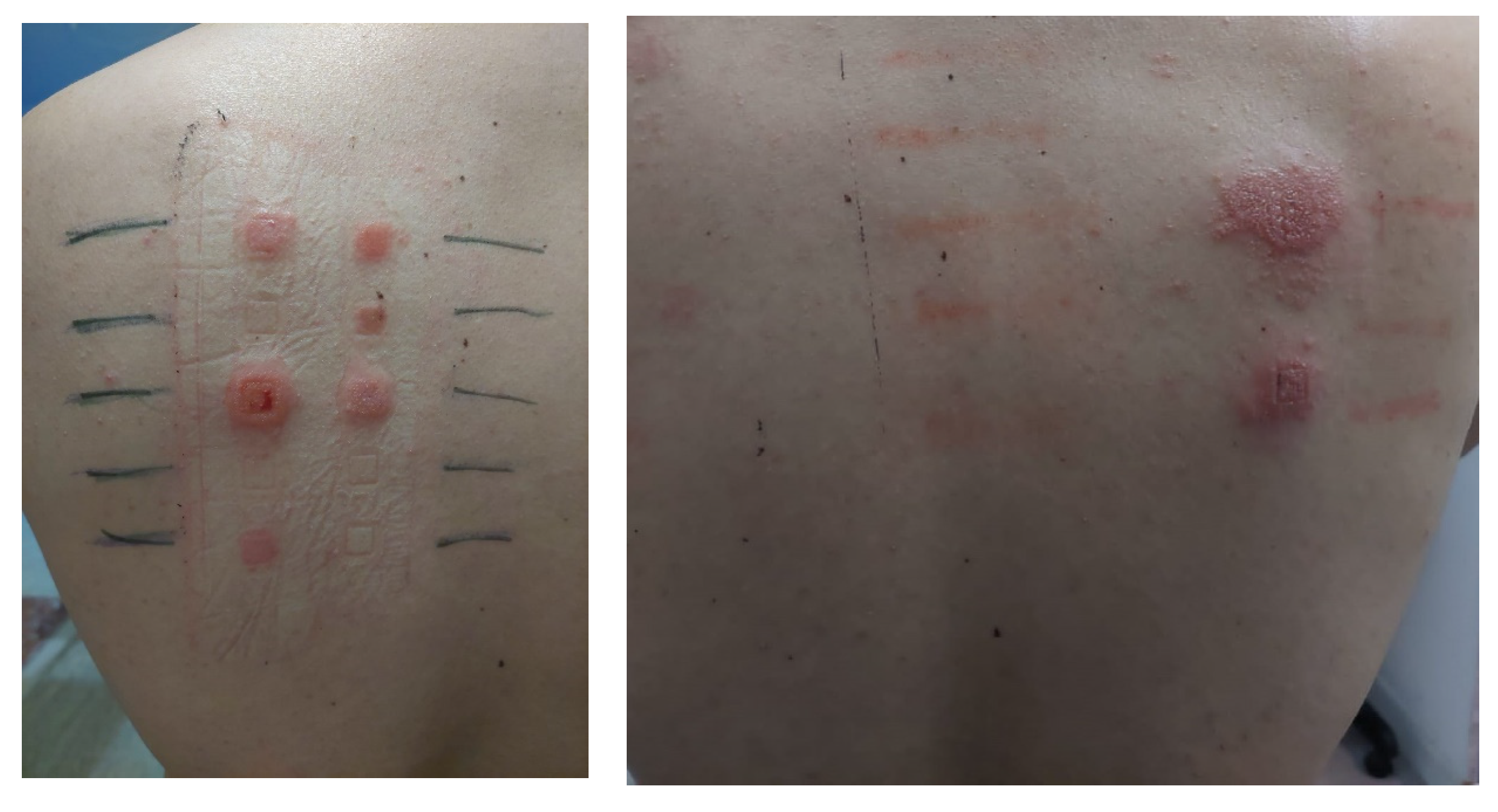 Allergies 02 00007 g002