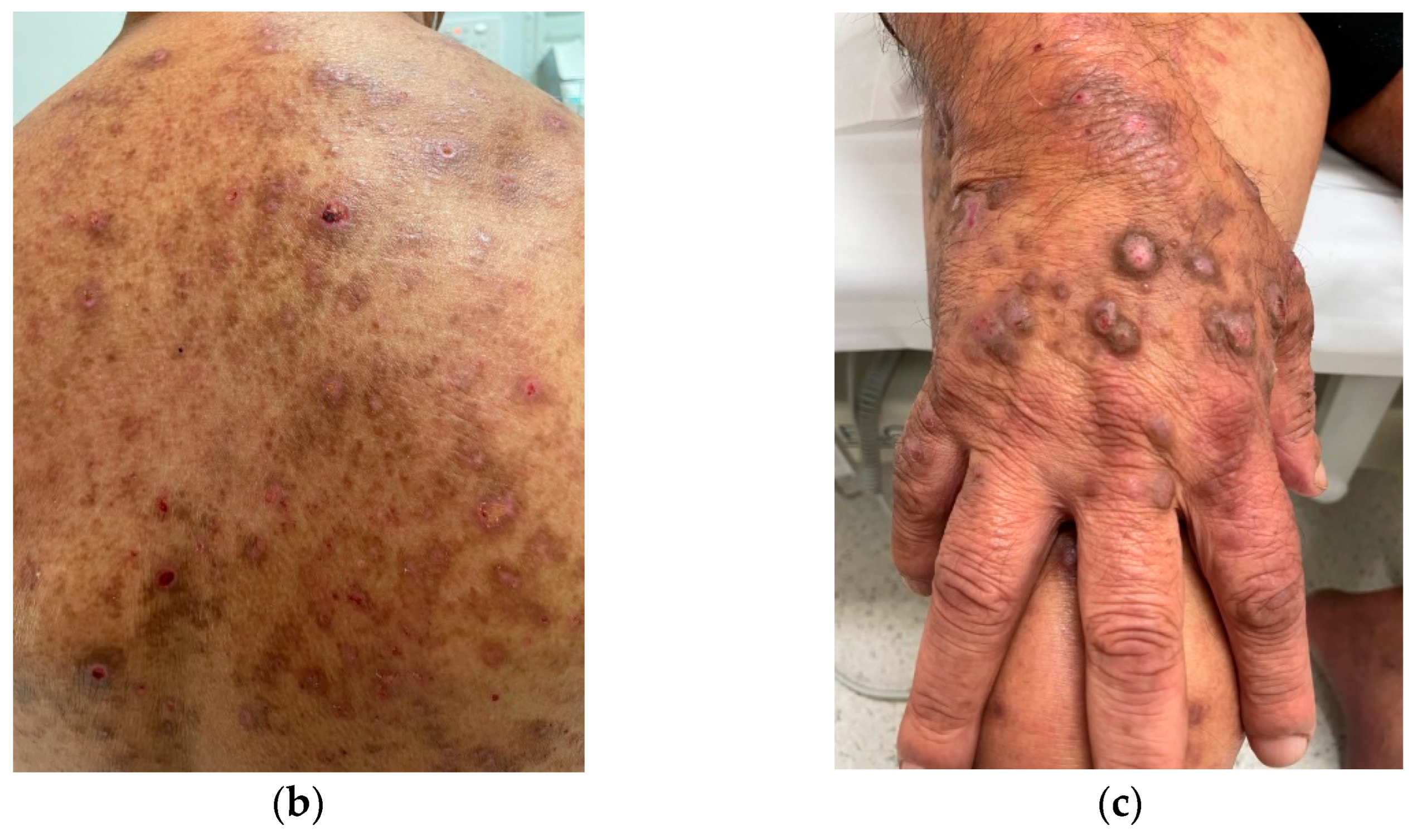 Allergies 02 00009 g002b