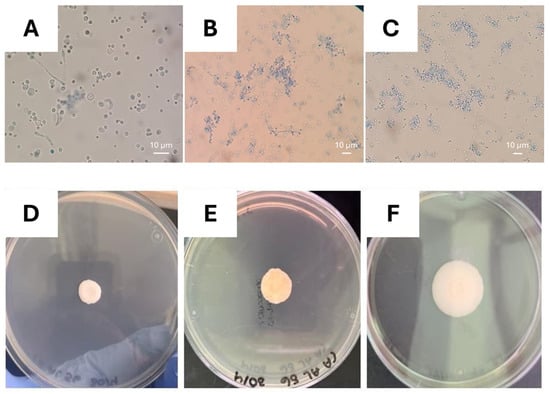 Photographs of the microscopic and macroscopic morphology of Candida spp. isolated from genitourinary samples. Septate hyaline mycelium and blastospores of (A) C. albicans and (B) C. tropicalis and (C) blastospores of N. glabratus. Wet mounts were made with lactophenol cotton-blue reagent and observed at 40×. Example of colony growth of Candida sp. on SGM incubated at 37 °C are presented in (D) colony after three days, (E) after five days, and (F) after ten days.
