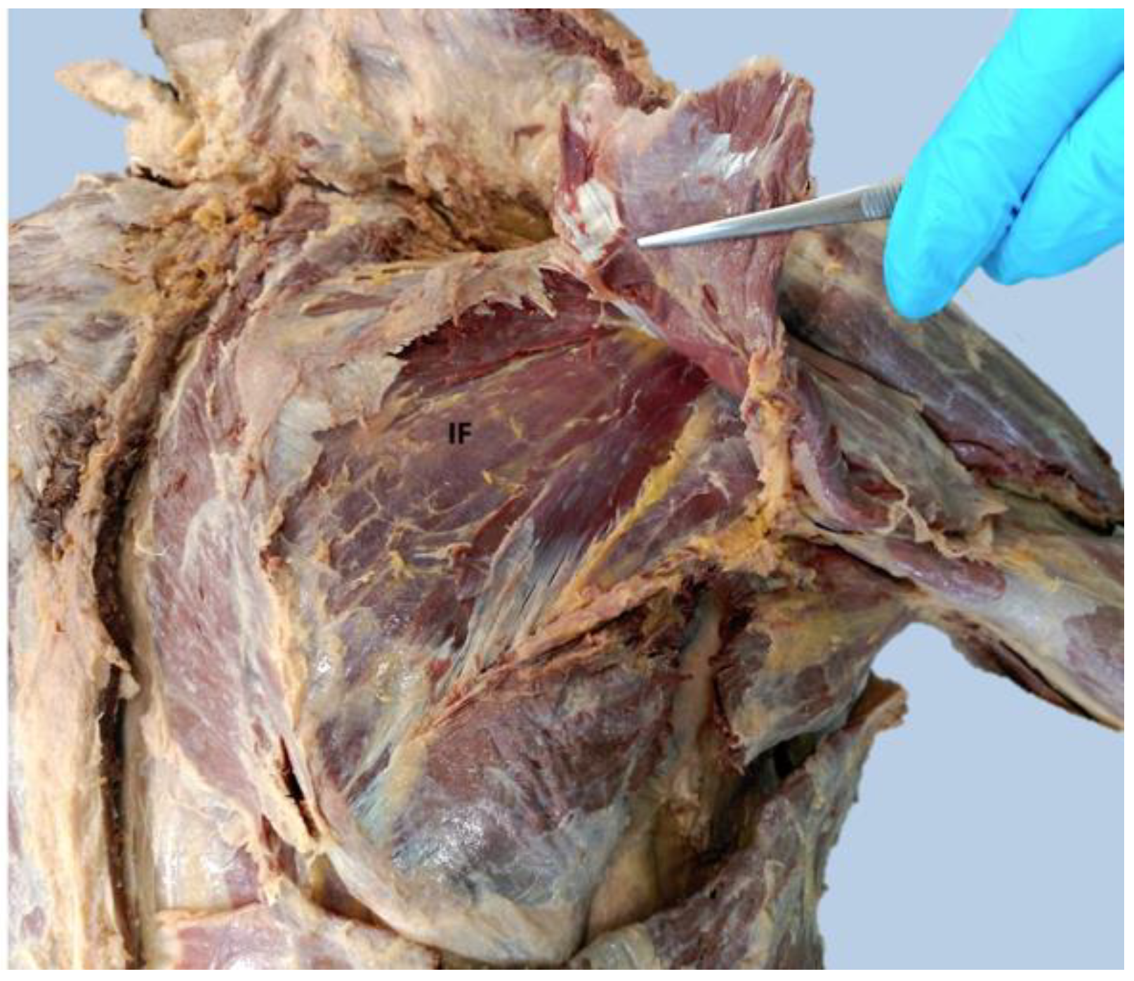 Anatomia 01 00012 g003 Anatomia 01 00012 g003