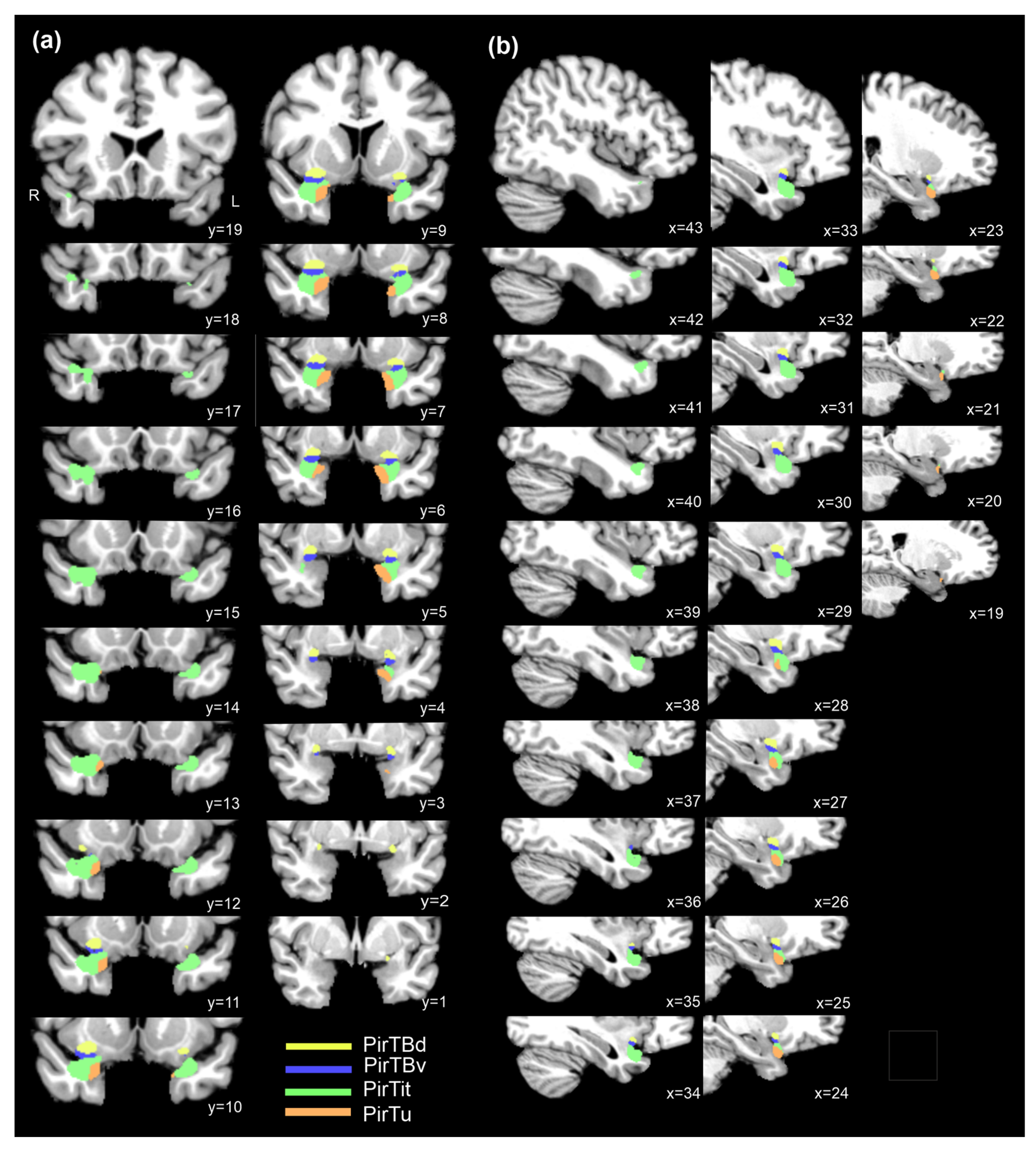 Anatomia 03 00007 g009 Anatomia 03 00007 g009