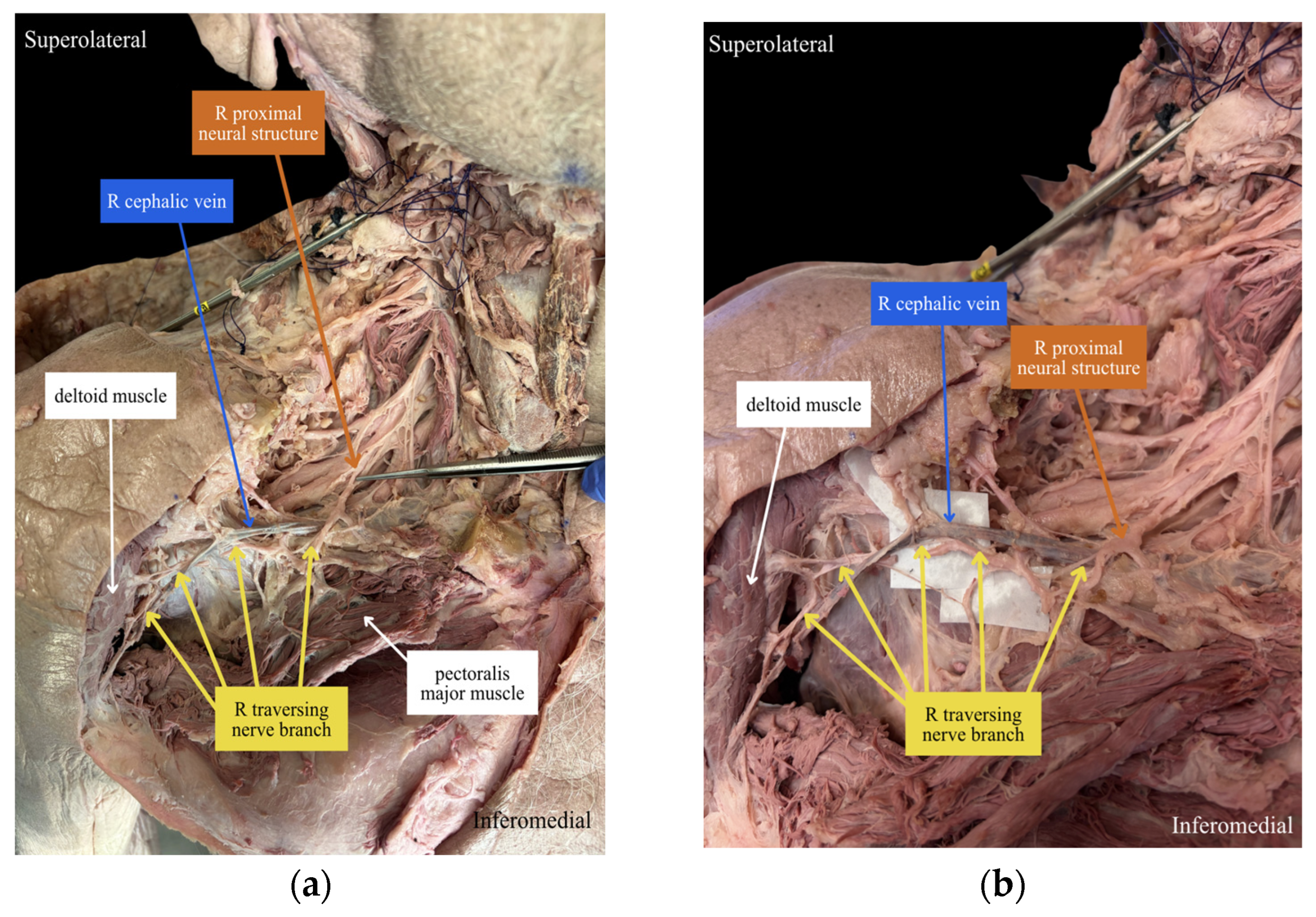 Anatomia 05 00028 g001 Anatomia 05 00028 g001