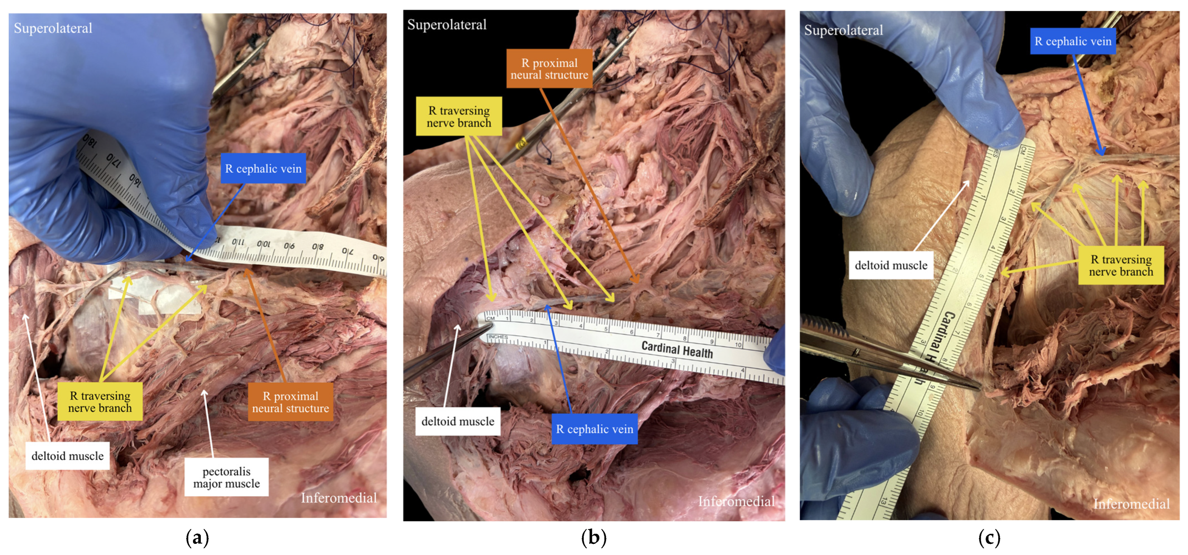 Anatomia 05 00028 g002 Anatomia 05 00028 g002