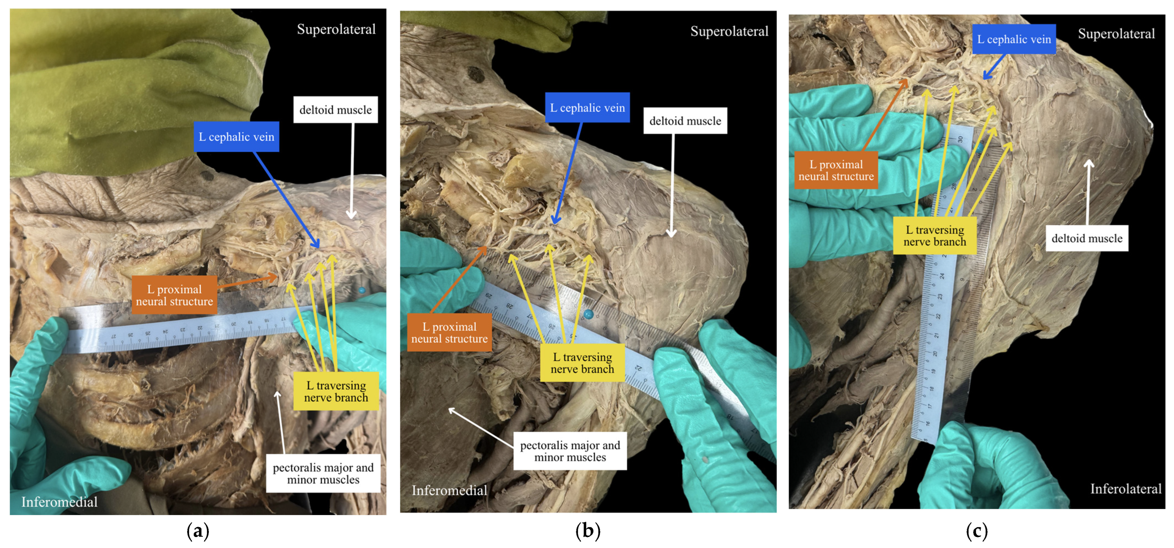 Anatomia 05 00028 g005 Anatomia 05 00028 g005