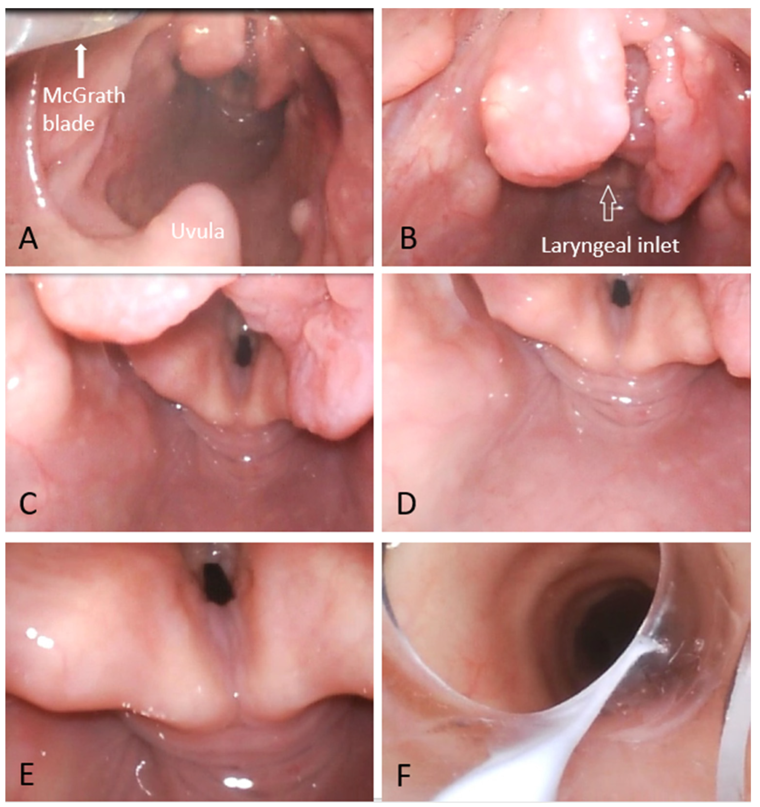 Anesthres 02 00005 g003