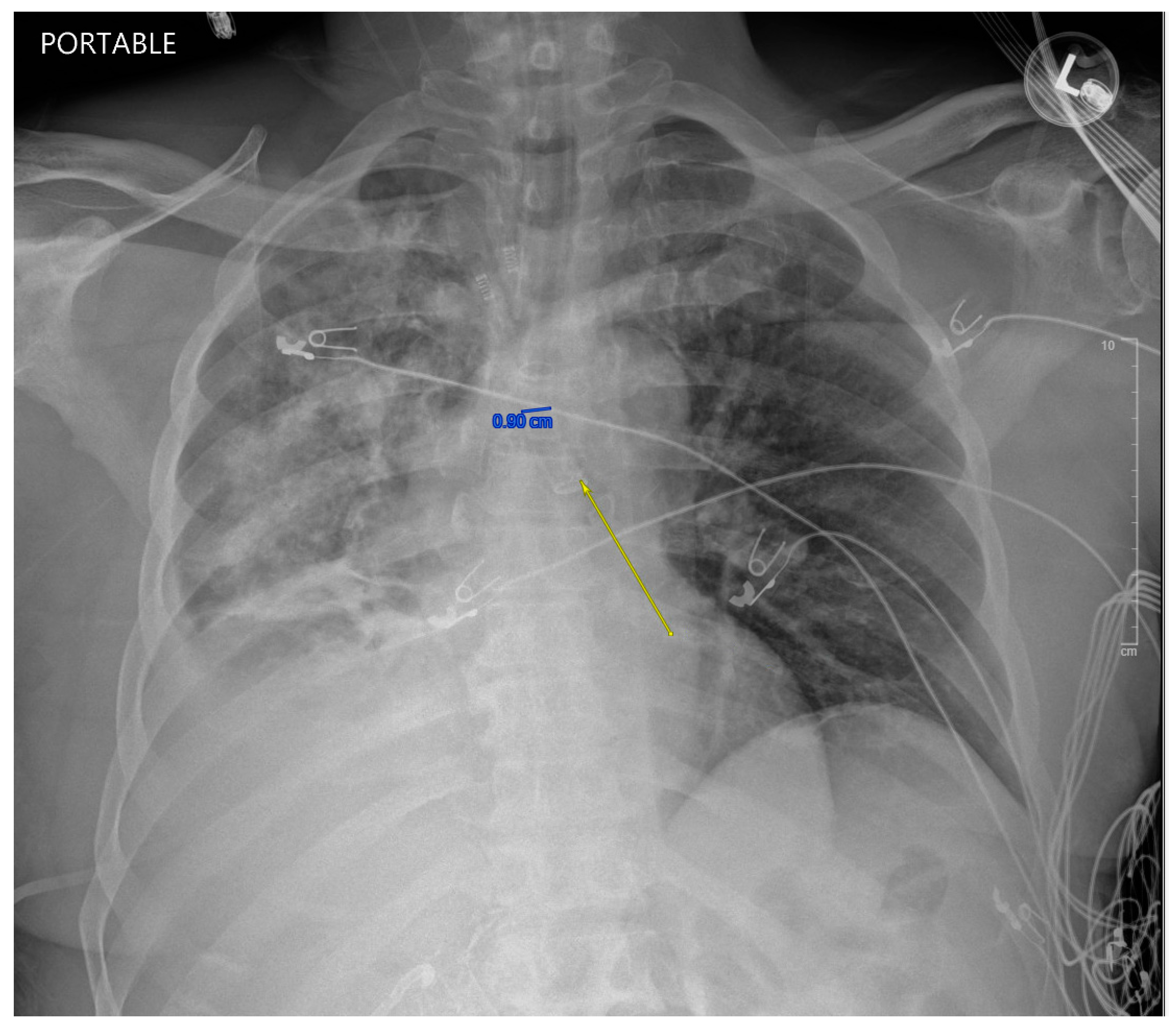 Anesthres 02 00017 g002