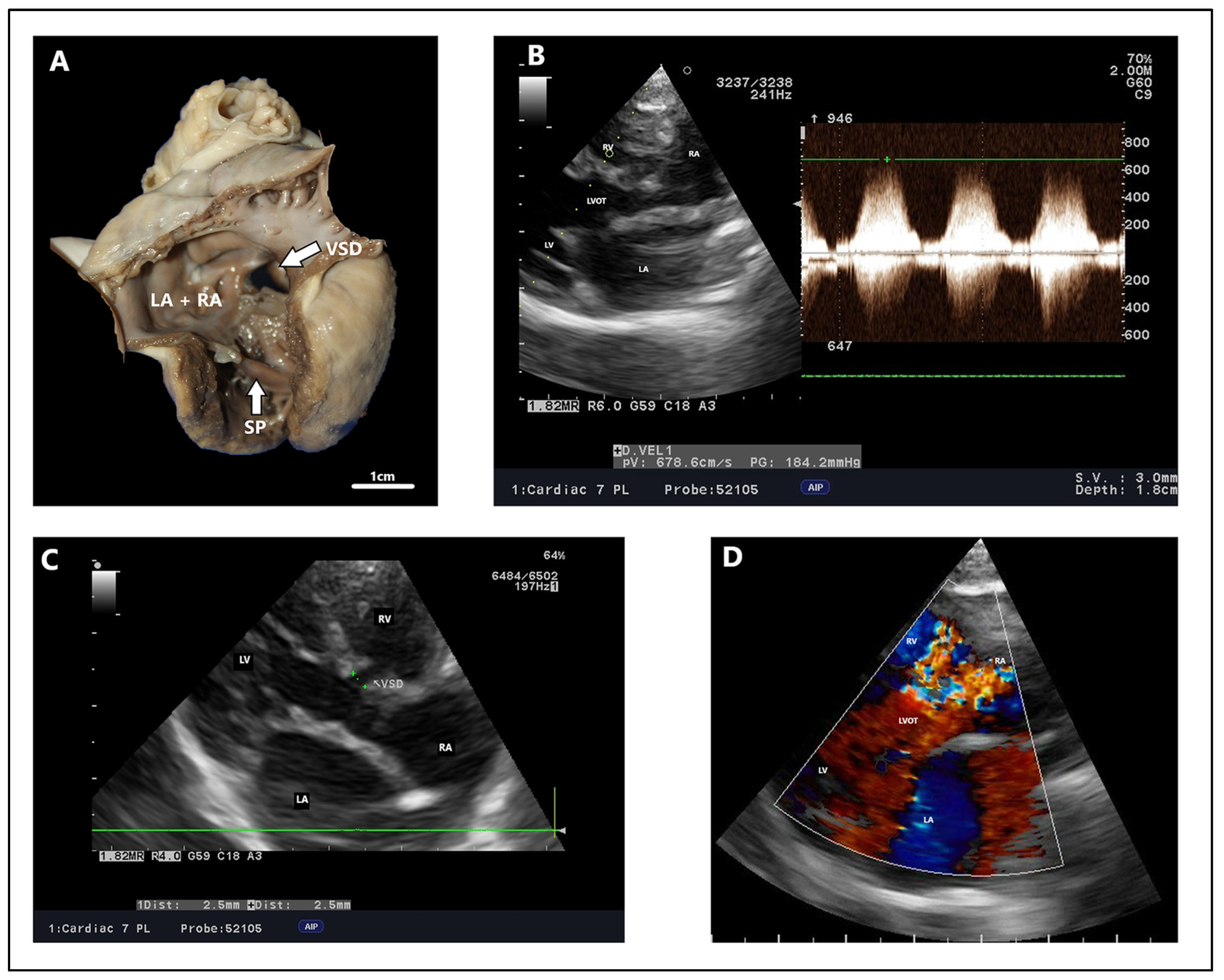Animals 15 00850 g005