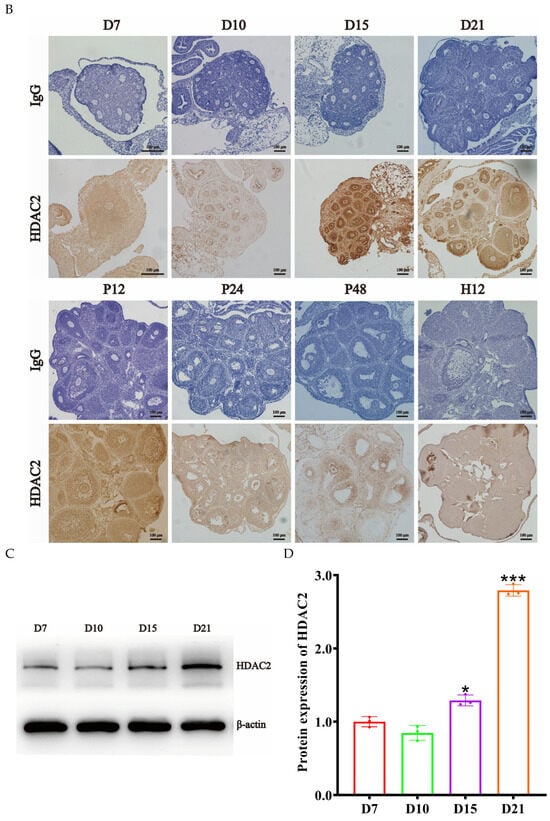 HDAC2-Specific Inhibitor Santacruzamate A Inhibits Mouse Preantral ...