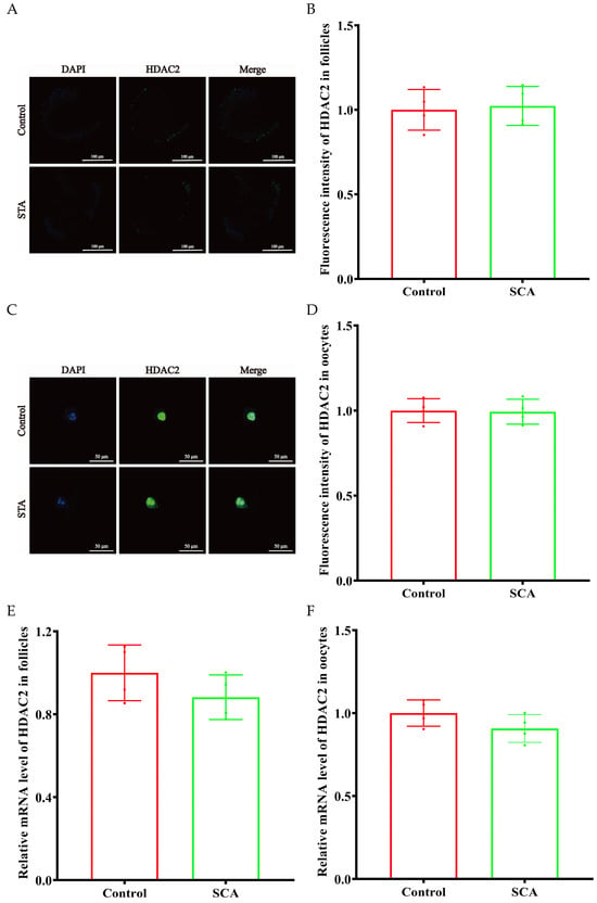 HDAC2-Specific Inhibitor Santacruzamate A Inhibits Mouse Preantral ...