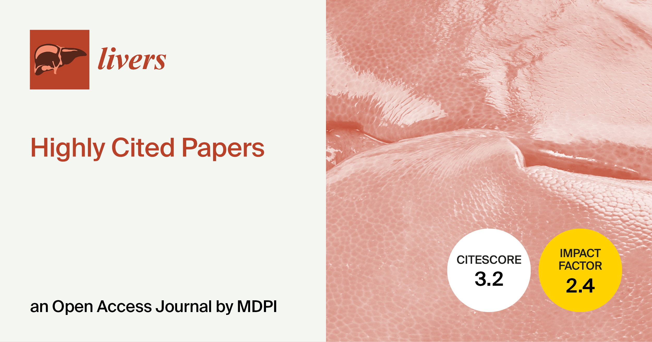 <strong><em>Livers</em> | Highly Cited Papers in 2023&ndash;2024</strong>