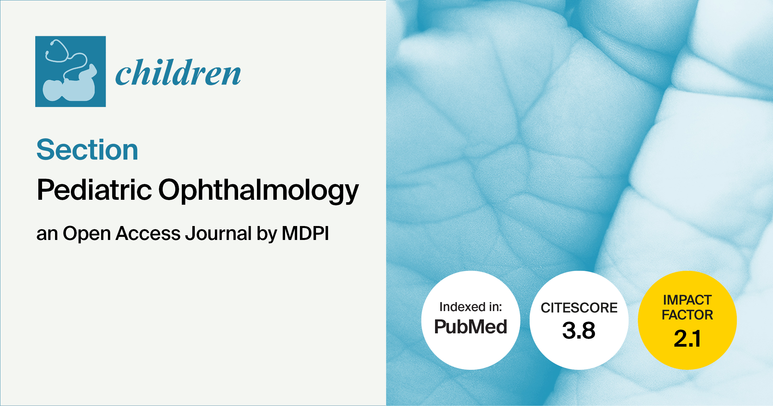 Children | Notable Articles Published in 2025 in the “Pediatric Ophthalmology” Section
