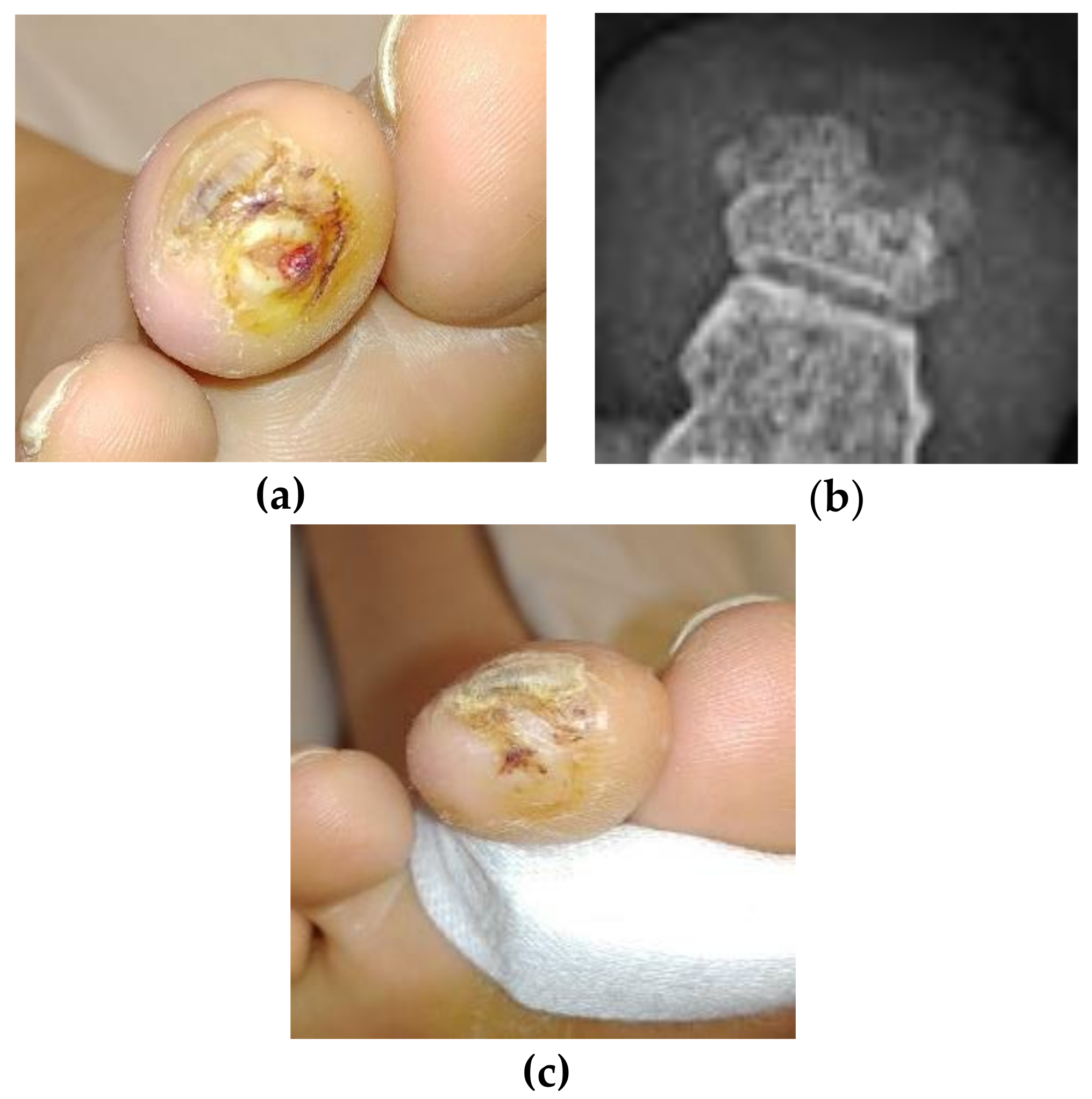 Antibiotics 07 00087 g003
