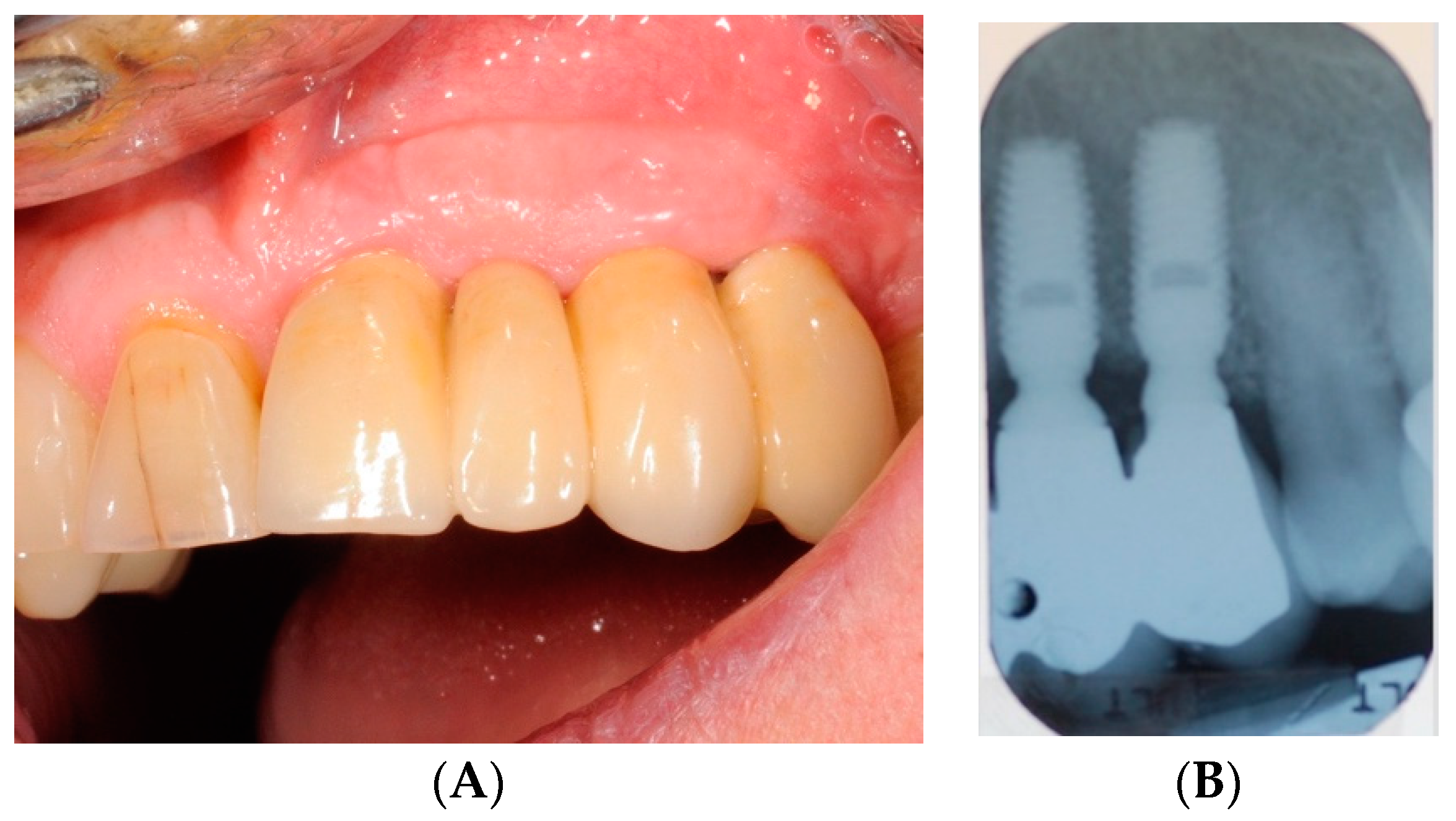 Antibiotics 08 00082 g004