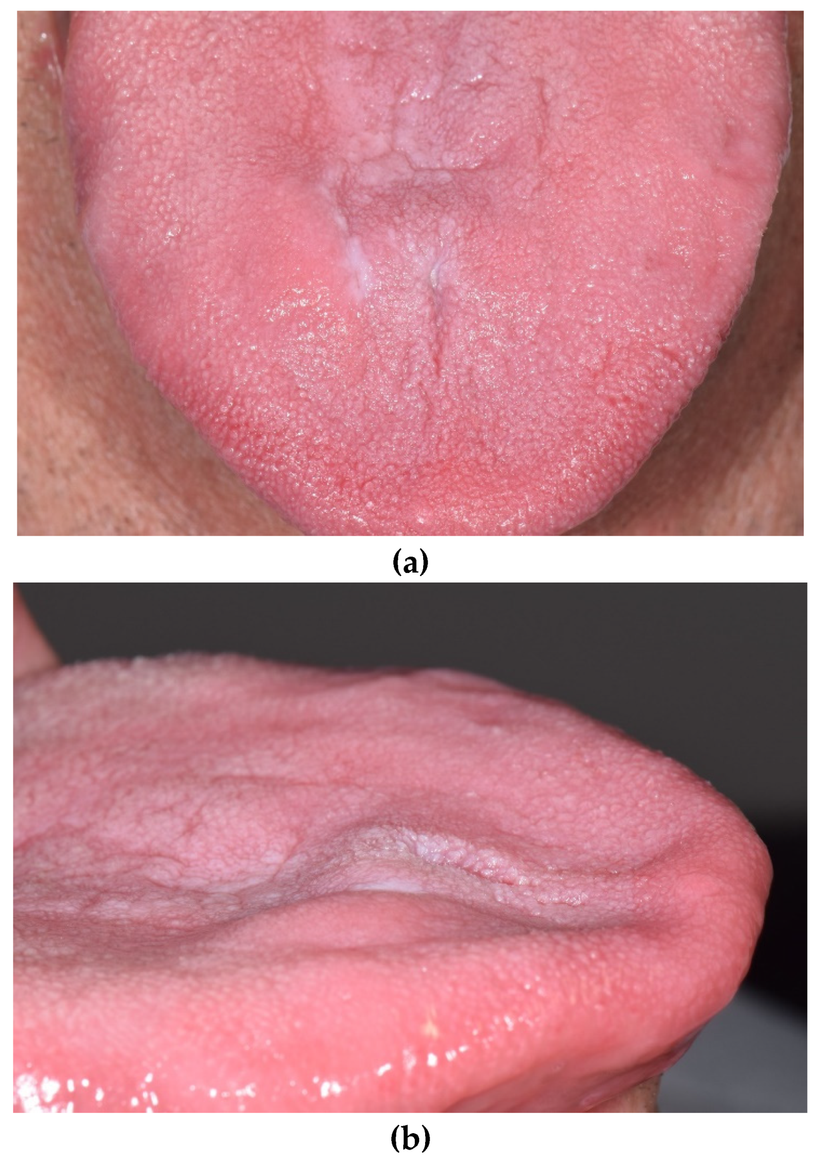 Antibiotics 09 00124 g001