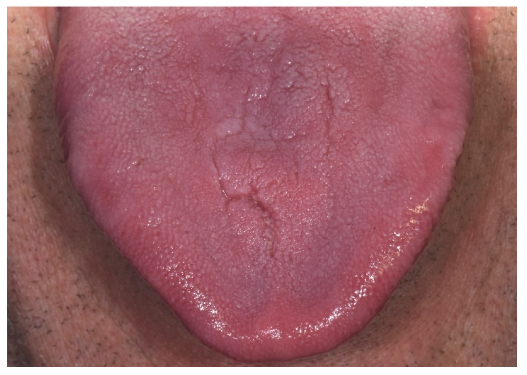 Antibiotics 09 00124 g002