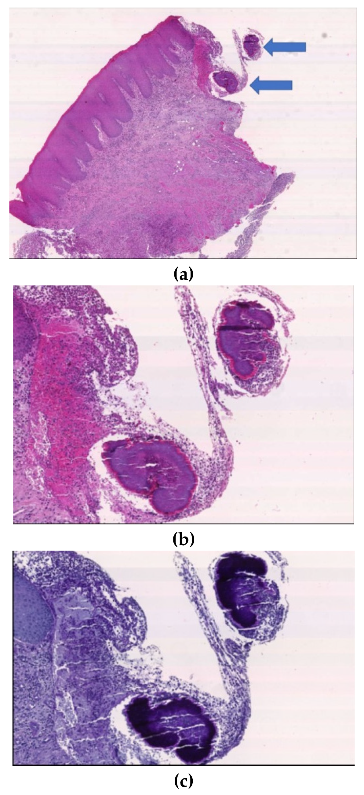 Antibiotics 09 00124 g003