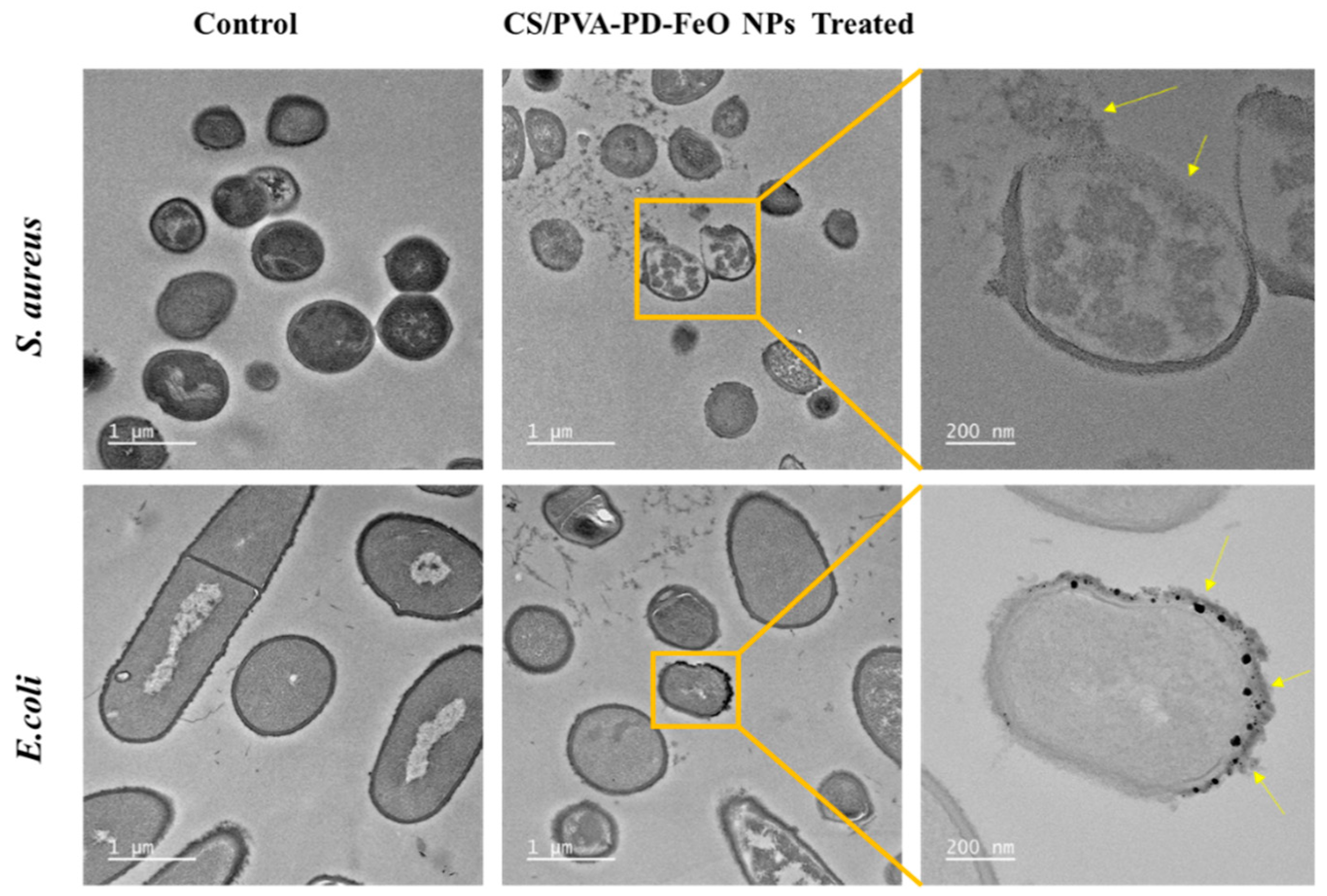 Antibiotics 10 00524 g008 Antibiotics 10 00524 g008