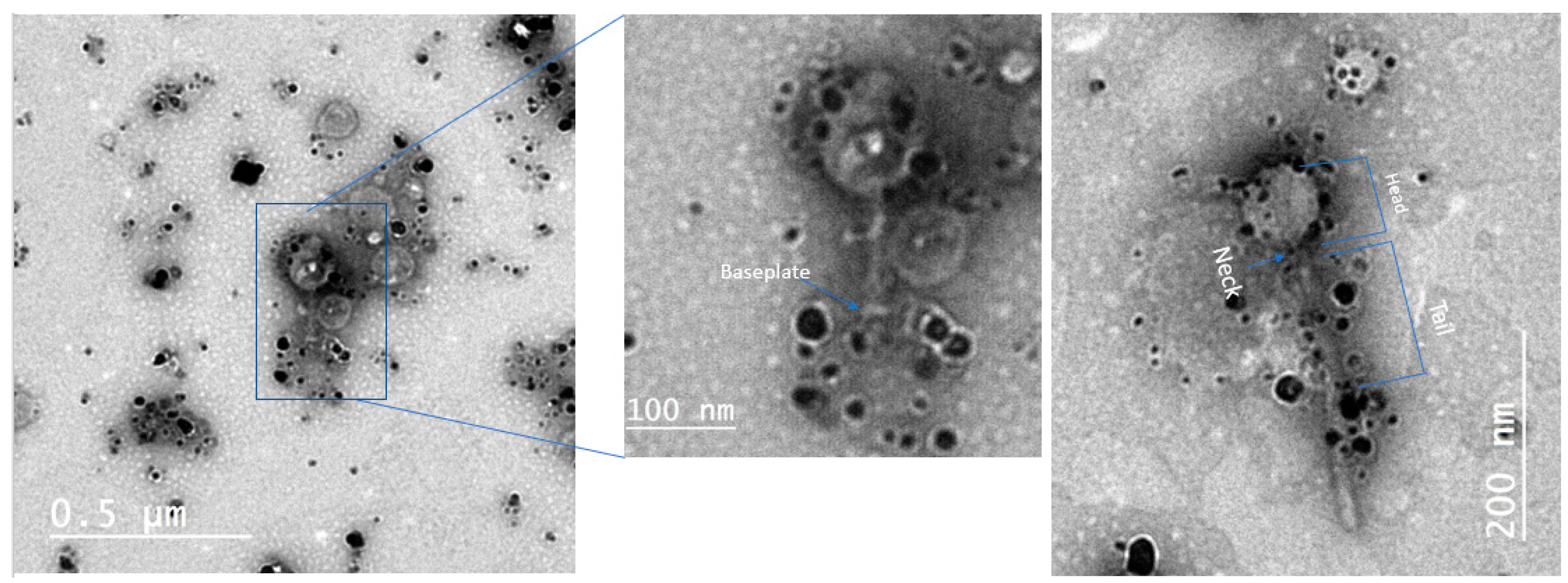 Antibiotics 10 00678 g004