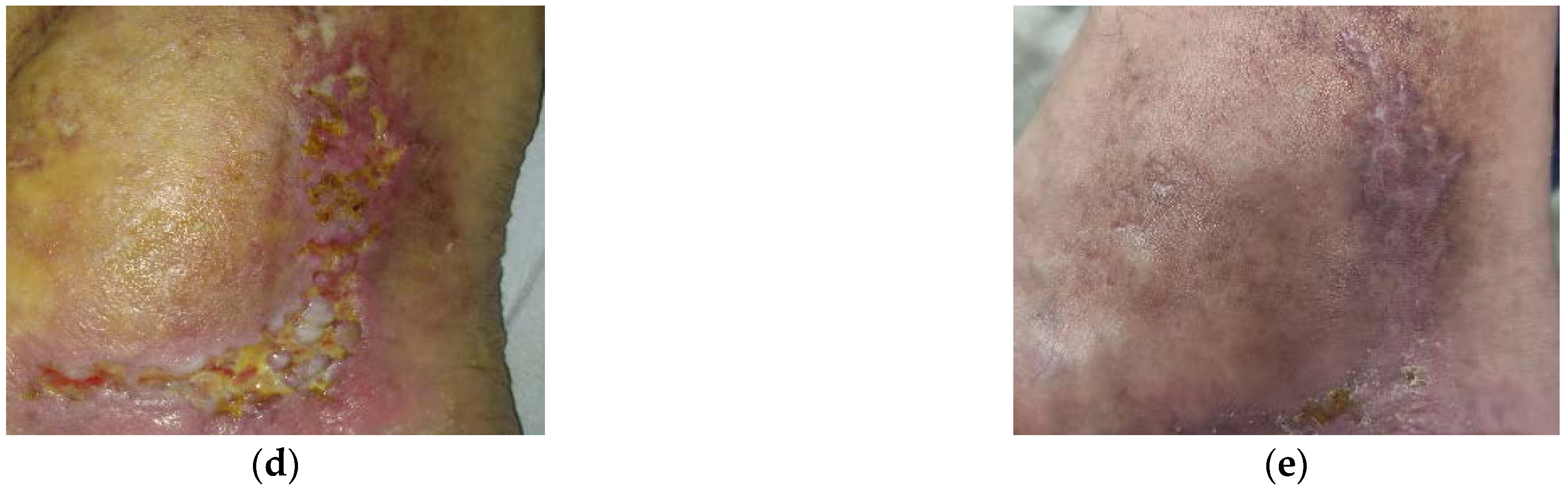 Antibiotics 10 00918 g002b