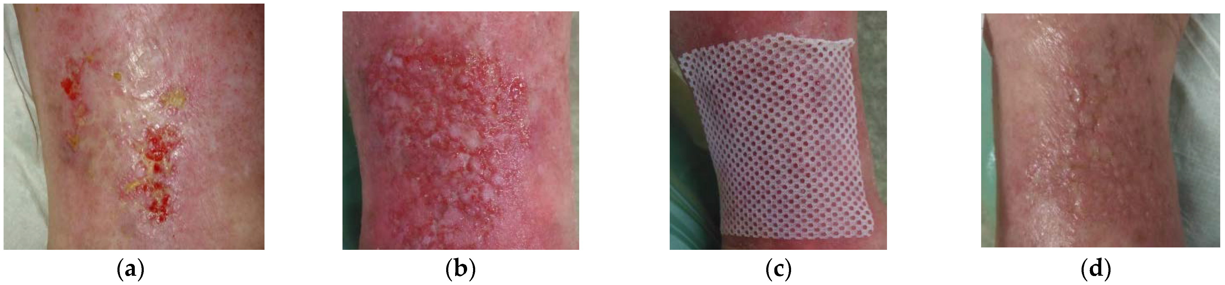 Antibiotics 10 00918 g004