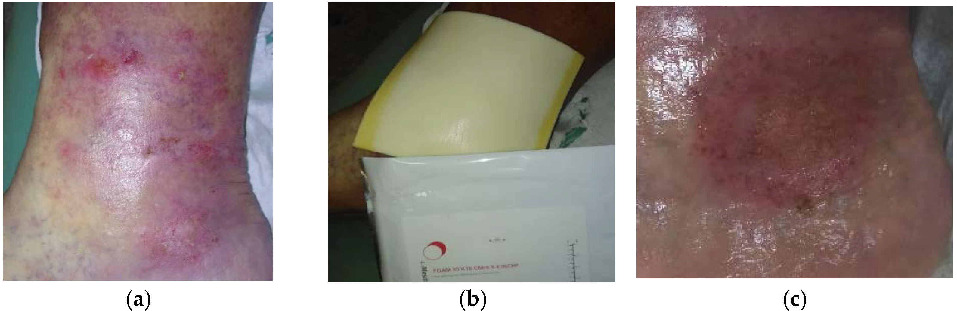 Antibiotics 10 00918 g006