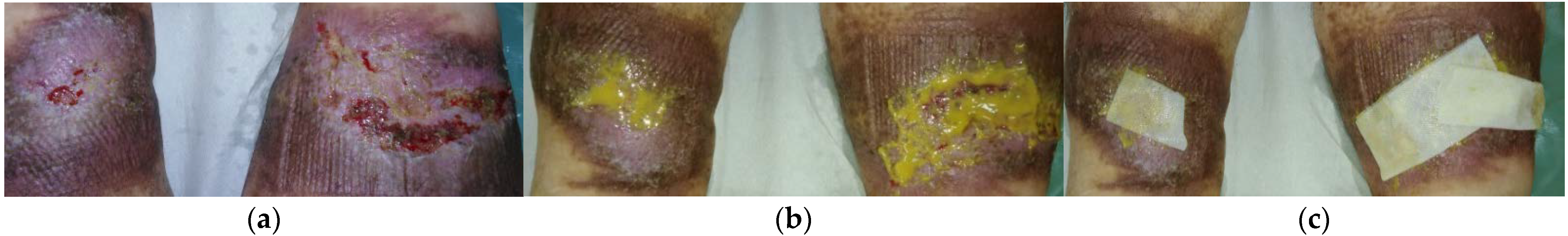 Antibiotics 10 00918 g007a