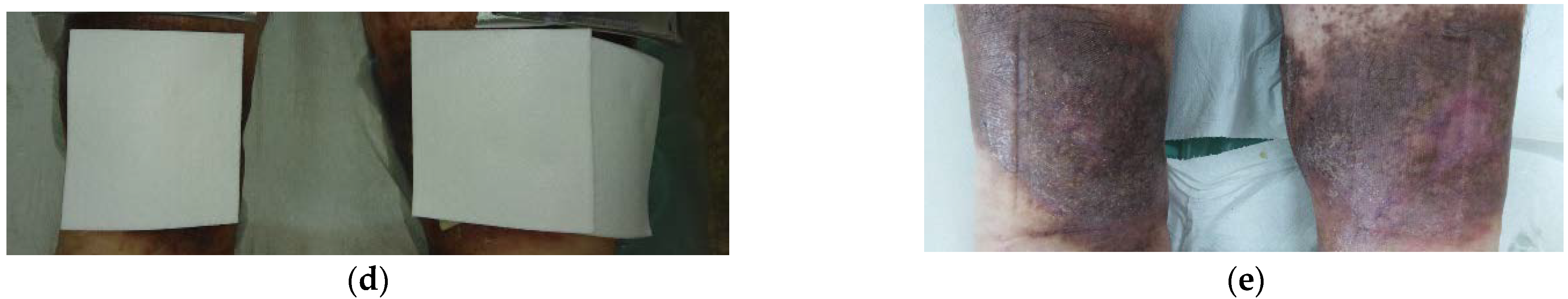 Antibiotics 10 00918 g007b