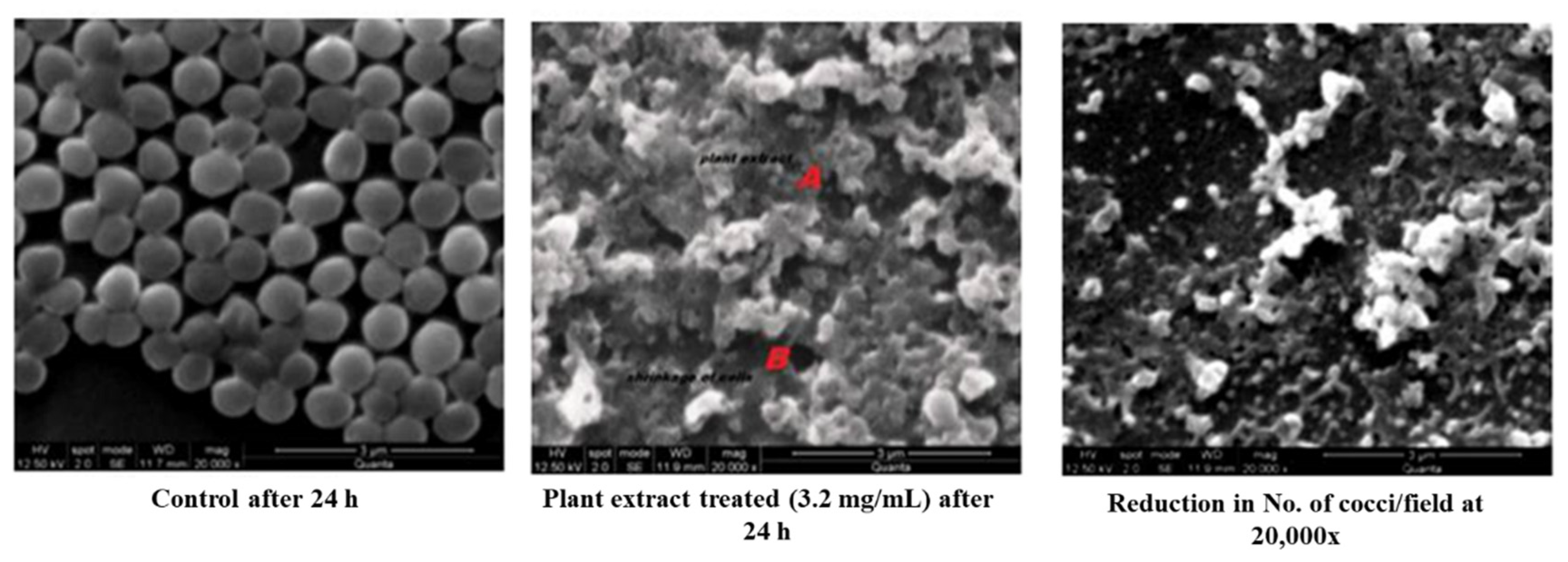 Antibiotics 11 00059 g002 Antibiotics 11 00059 g002