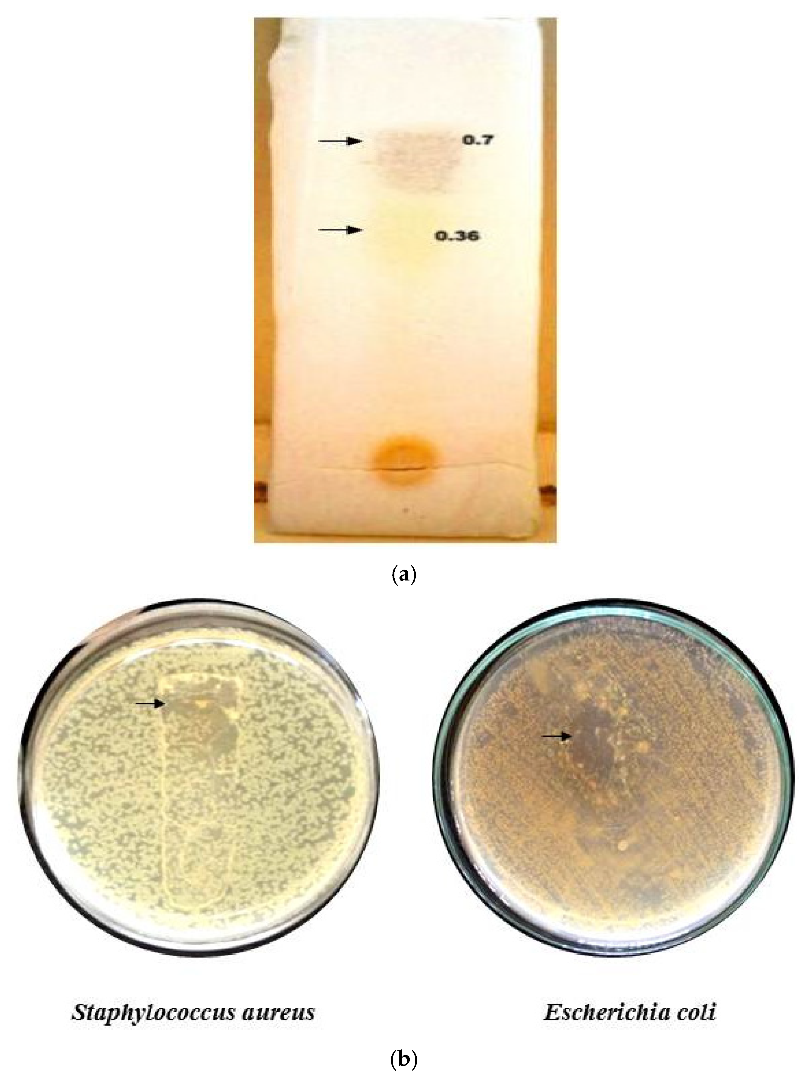 Antibiotics 11 00059 g005 Antibiotics 11 00059 g005
