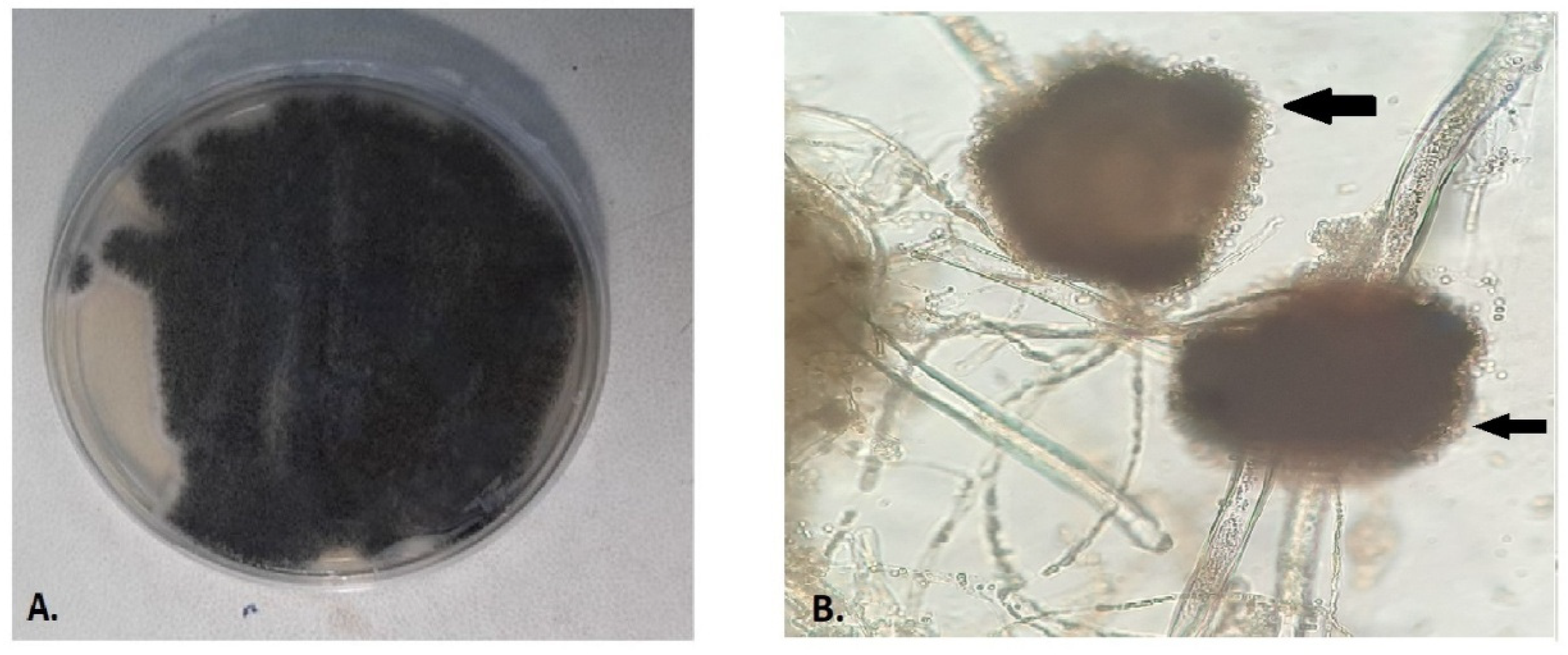 Antibiotics 11 00300 g001