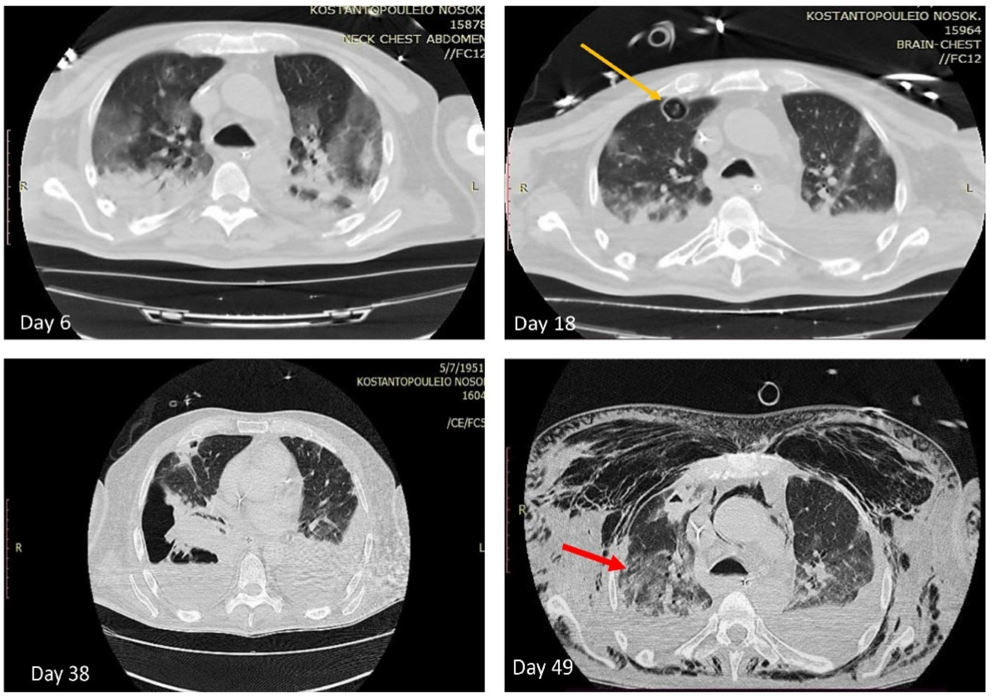 Antibiotics 11 00300 g002