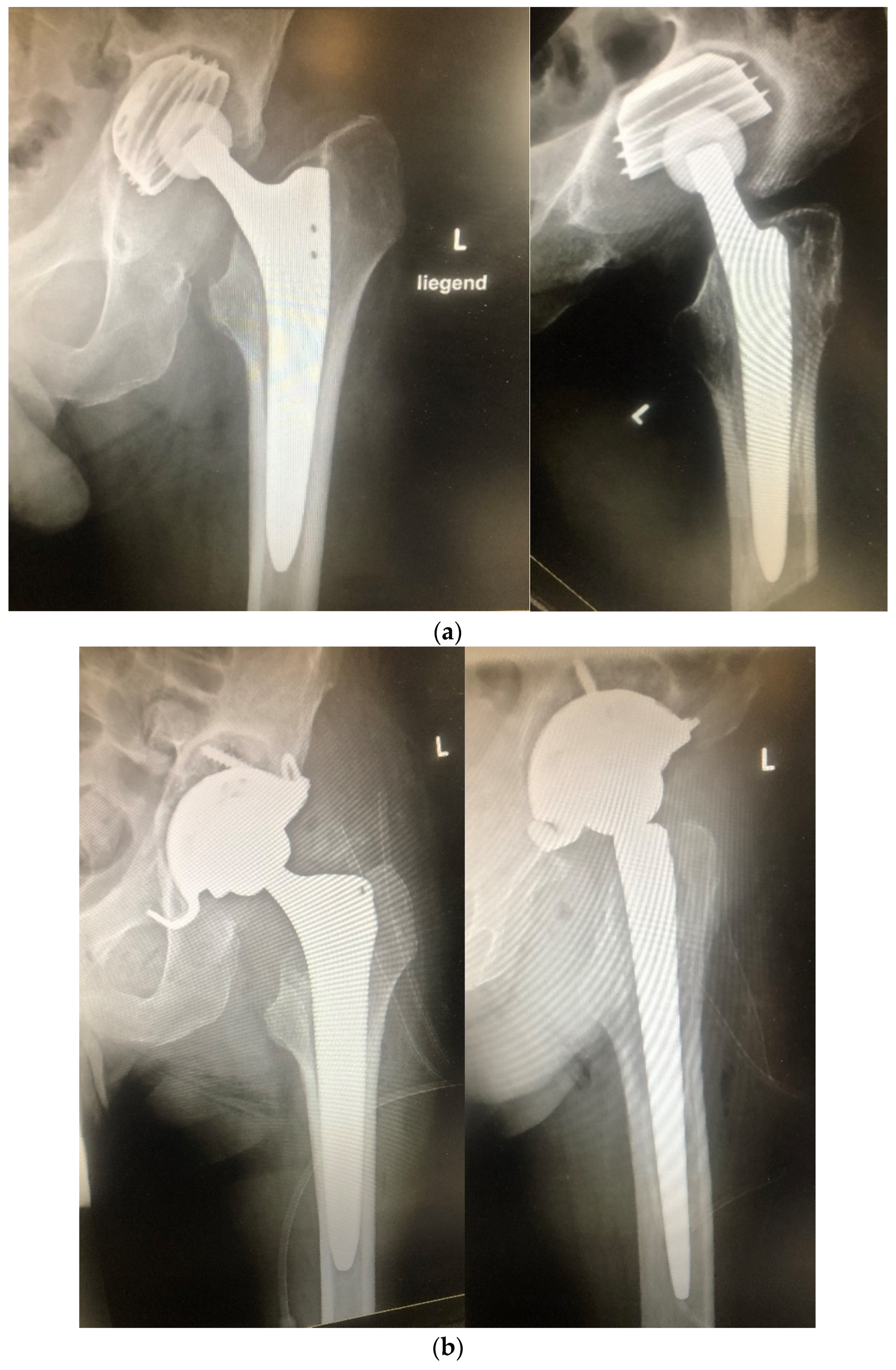 Antibiotics 11 00310 g004a