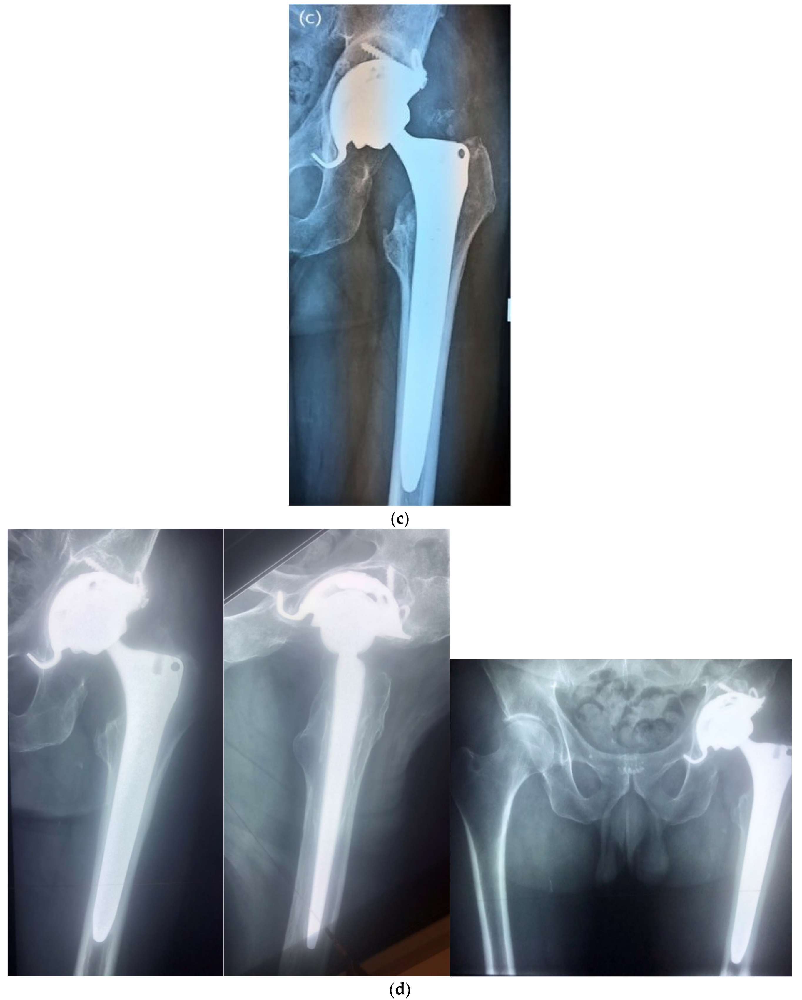 Antibiotics 11 00310 g004b