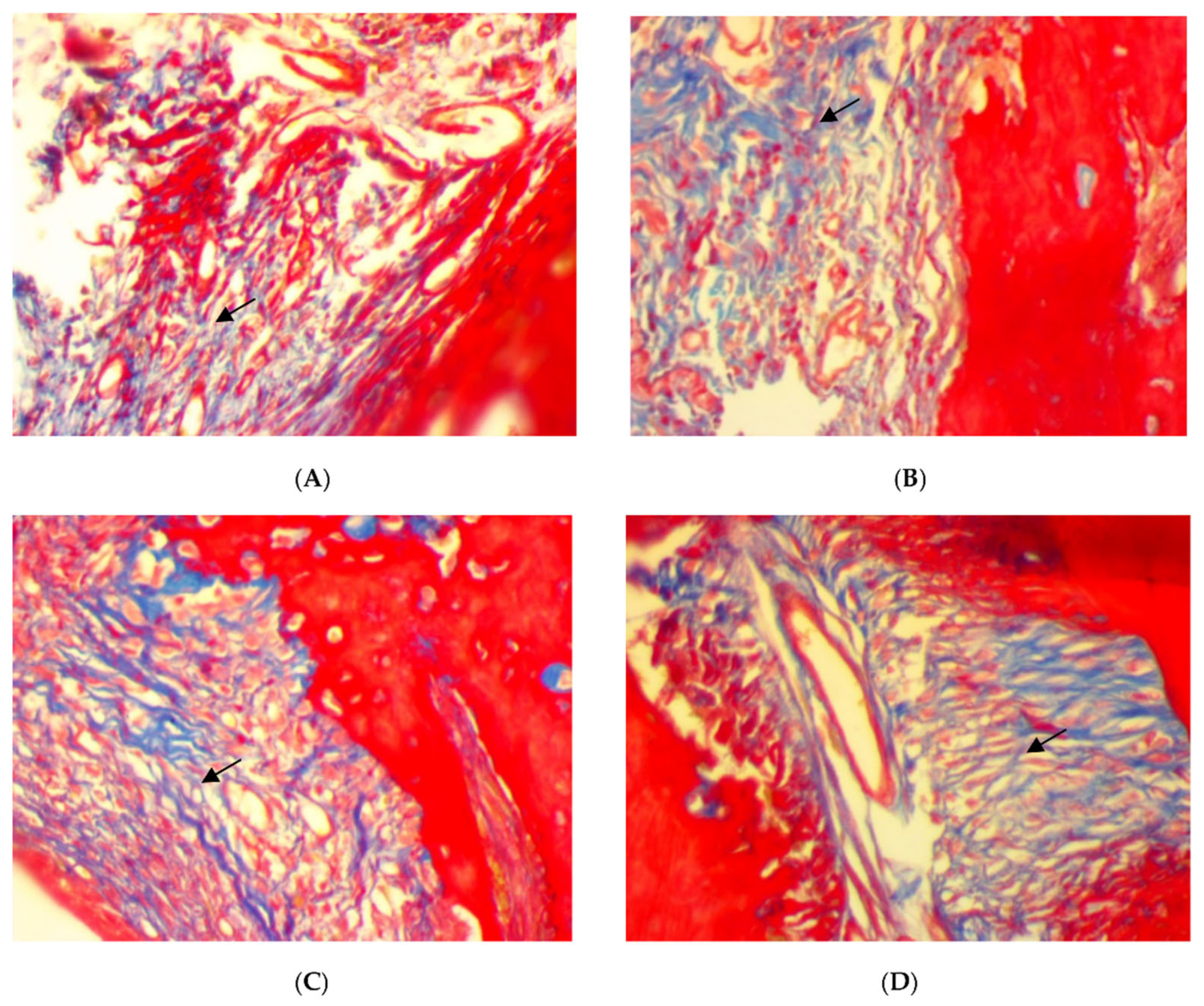 Antibiotics 11 00521 g004