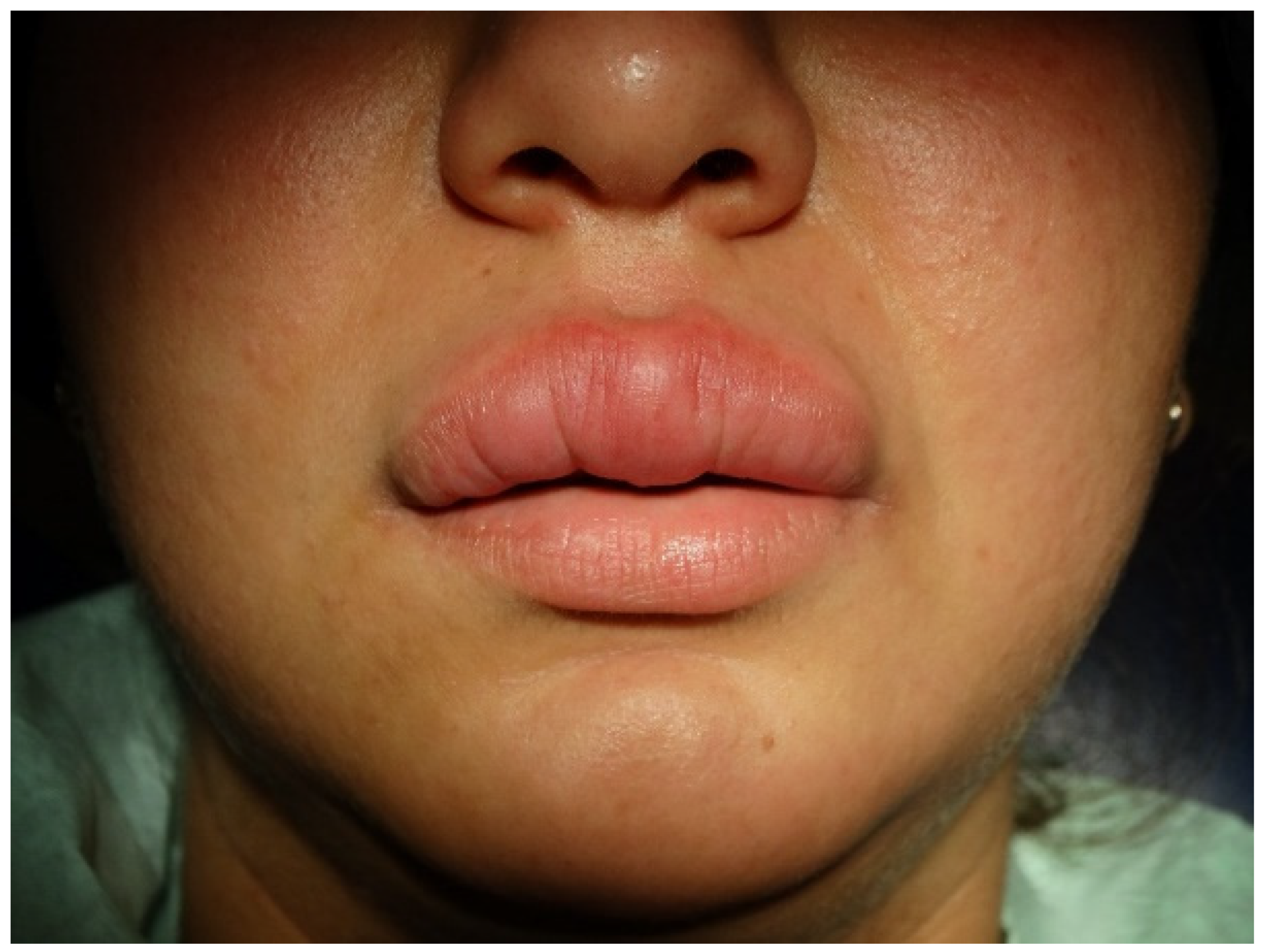 Antibiotics 11 00522 g001 Antibiotics 11 00522 g001