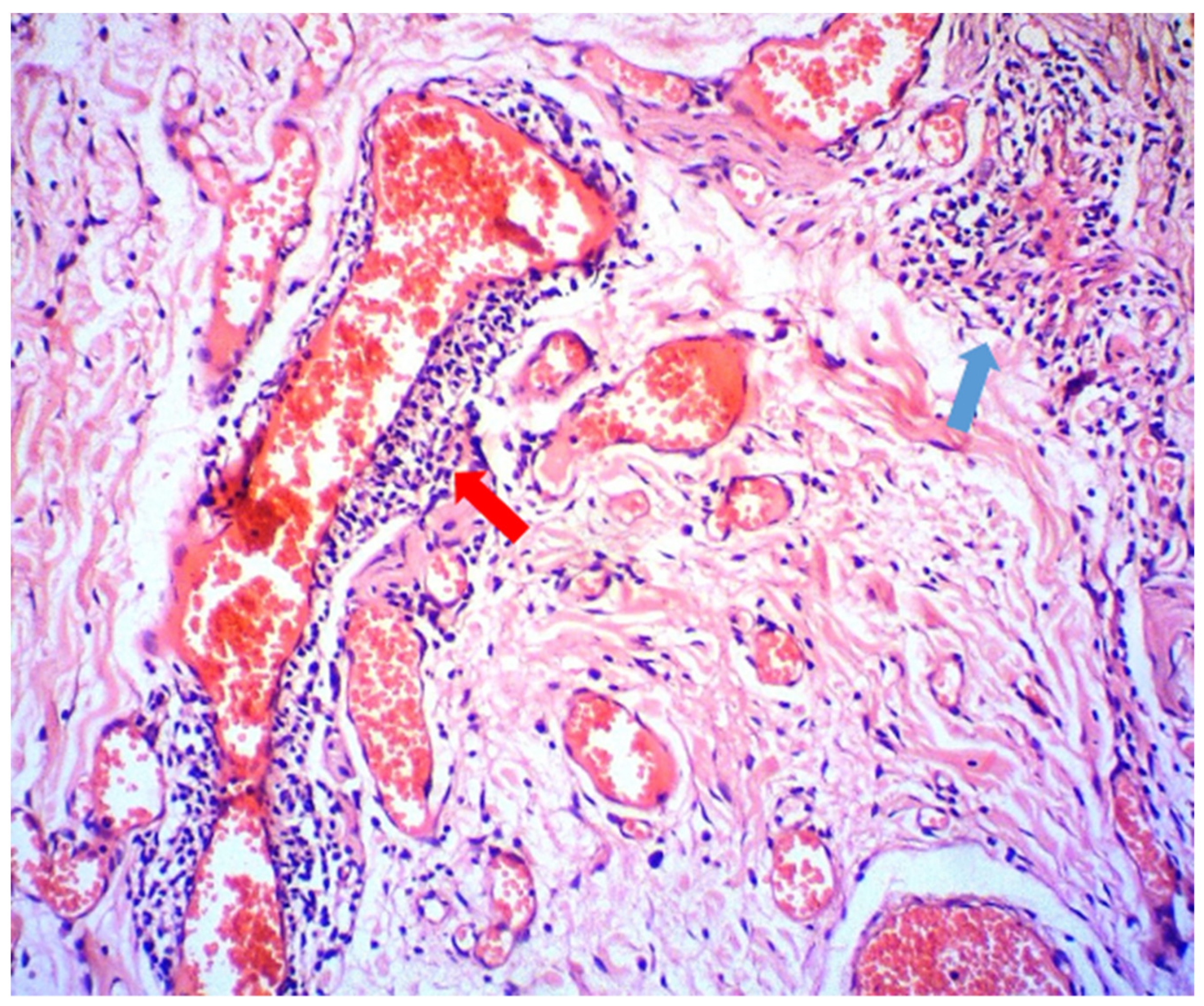 Antibiotics 11 00522 g002 Antibiotics 11 00522 g002