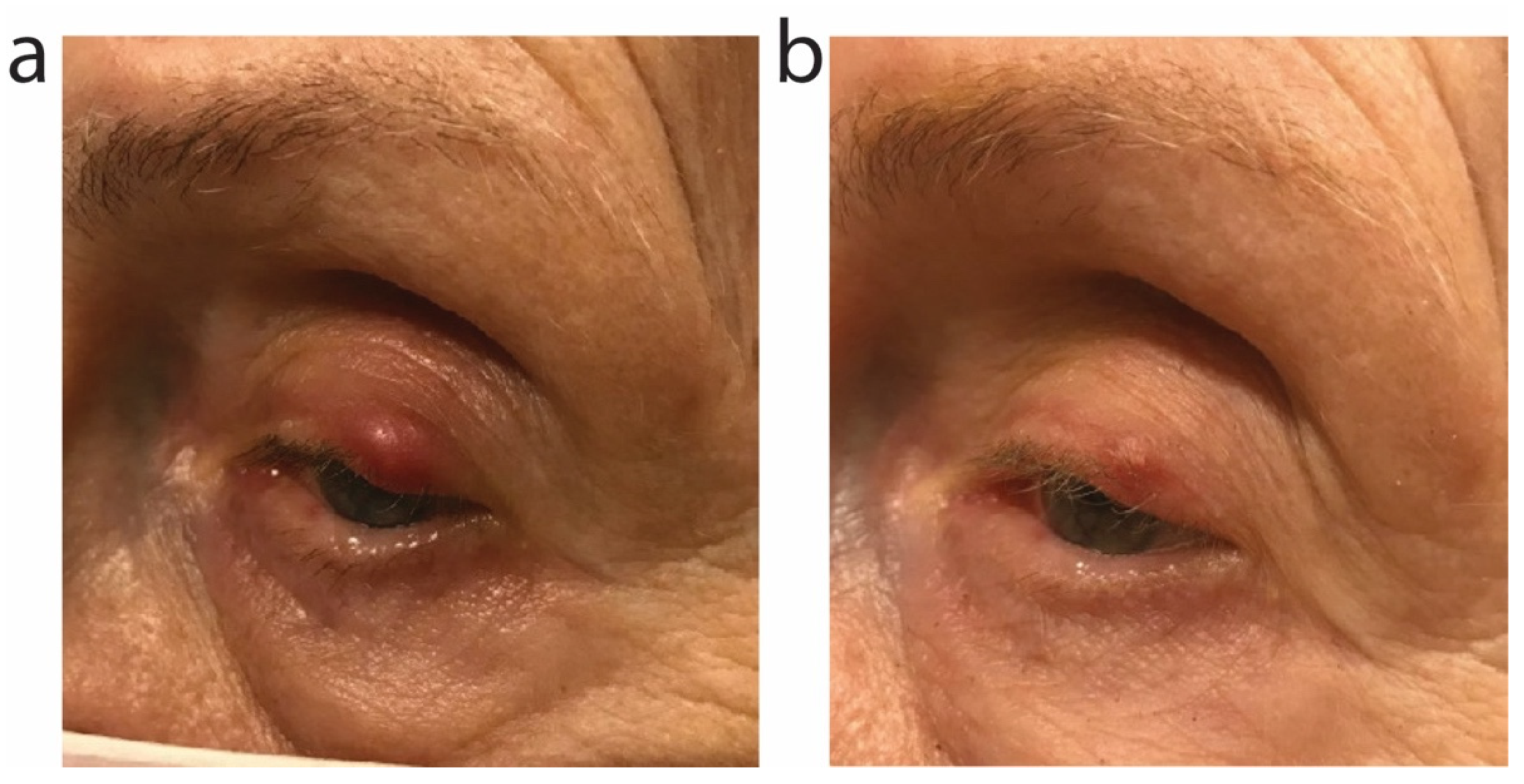 Antibiotics 11 00722 g006