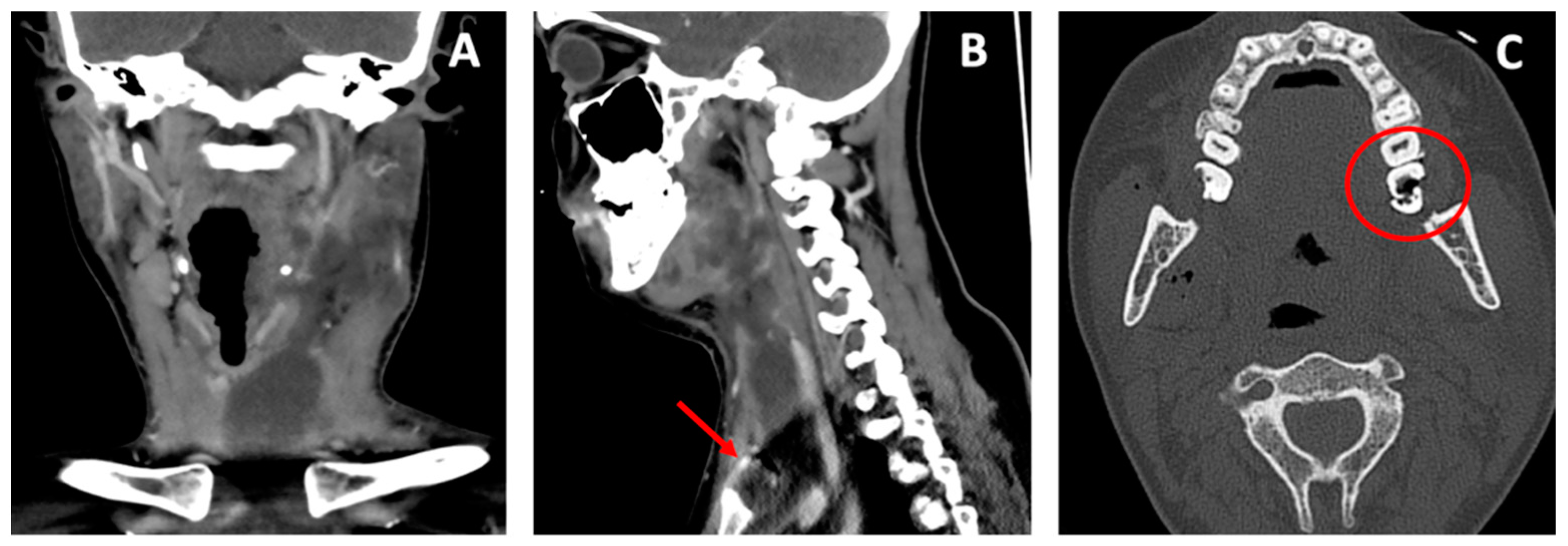 Antibiotics 11 01757 g001 Antibiotics 11 01757 g001