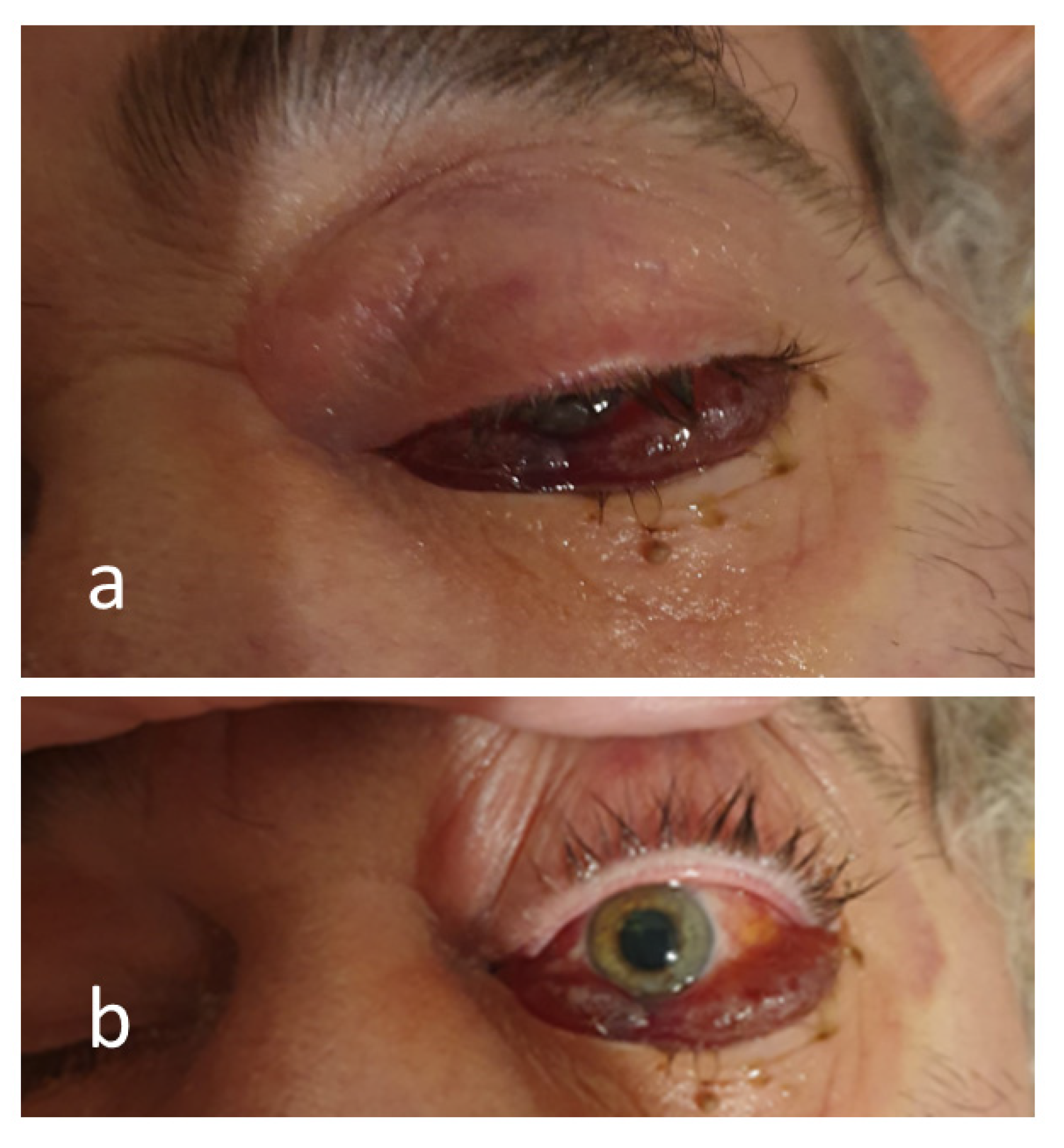 Antibiotics 12 00031 g002 Antibiotics 12 00031 g002