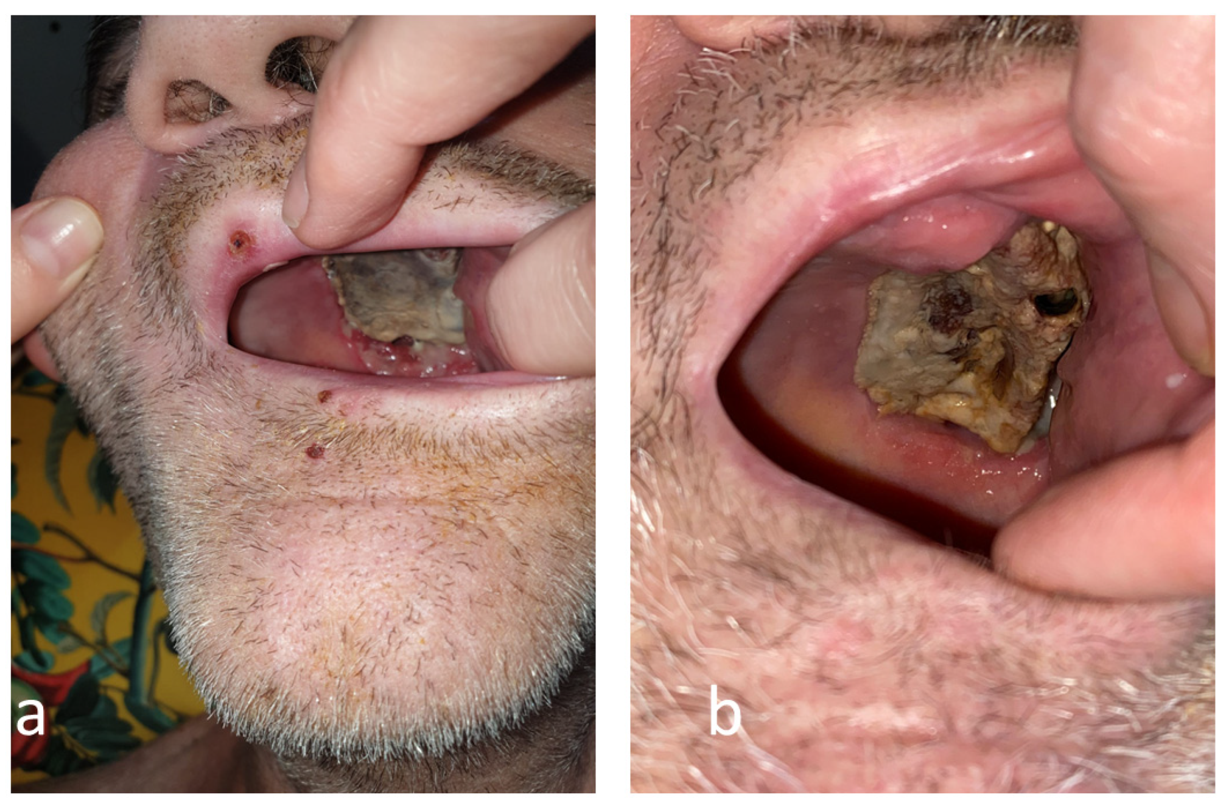 Antibiotics 12 00031 g003 Antibiotics 12 00031 g003
