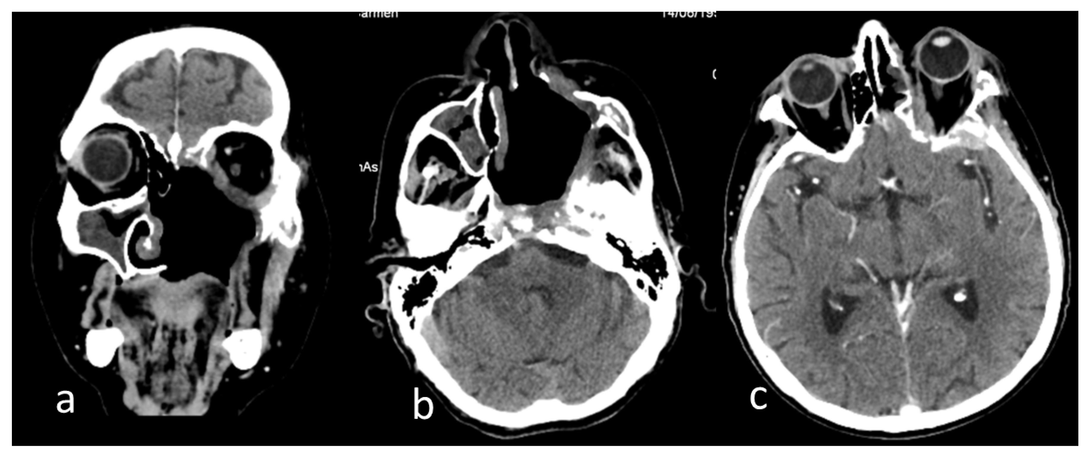 Antibiotics 12 00031 g004 Antibiotics 12 00031 g004