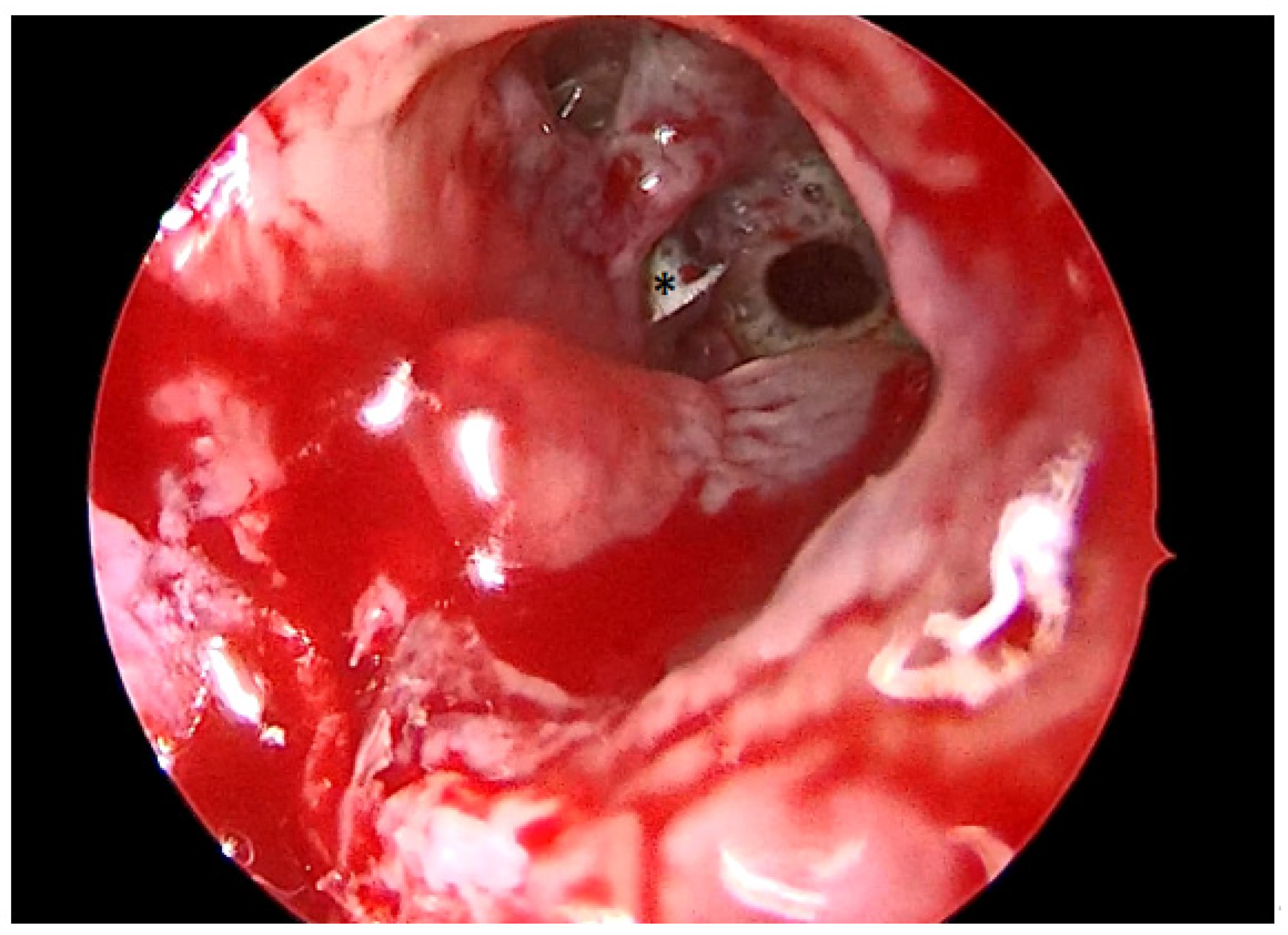 Antibiotics 12 00390 g002