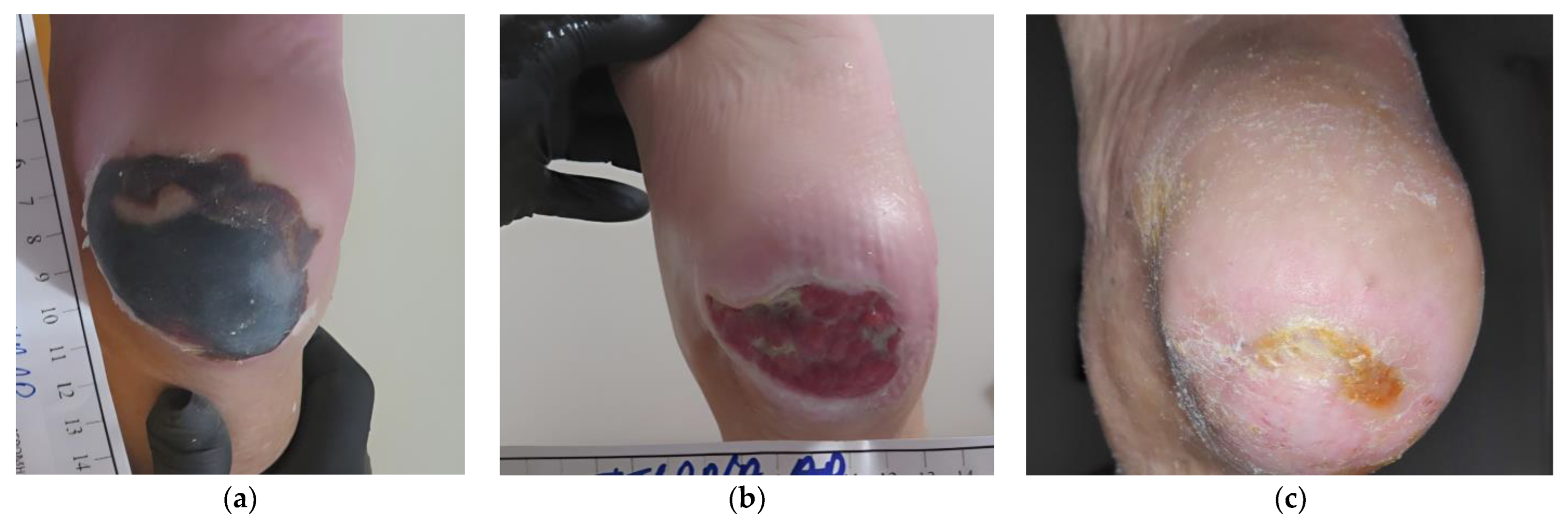 Antibiotics 12 00605 g004 Antibiotics 12 00605 g004