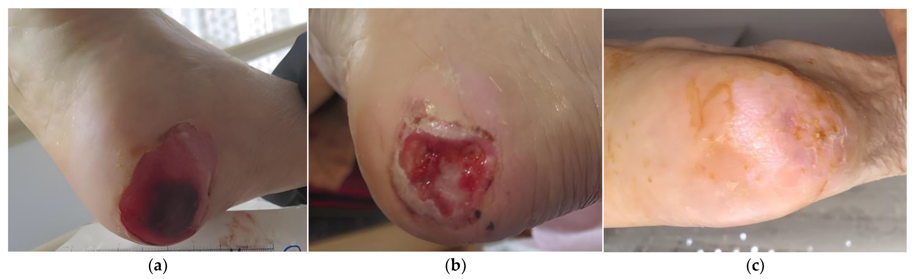 Antibiotics 12 00605 g005 Antibiotics 12 00605 g005