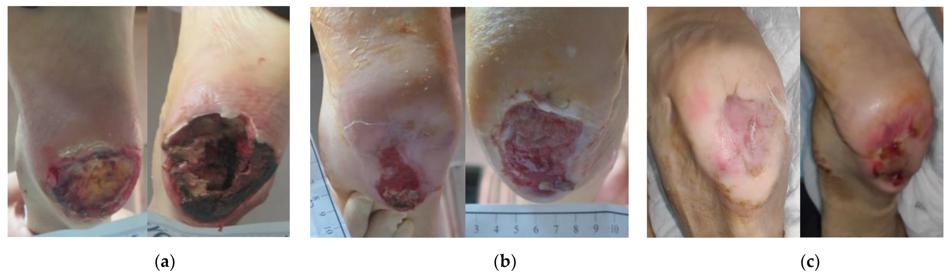 Antibiotics 12 00605 g006 Antibiotics 12 00605 g006