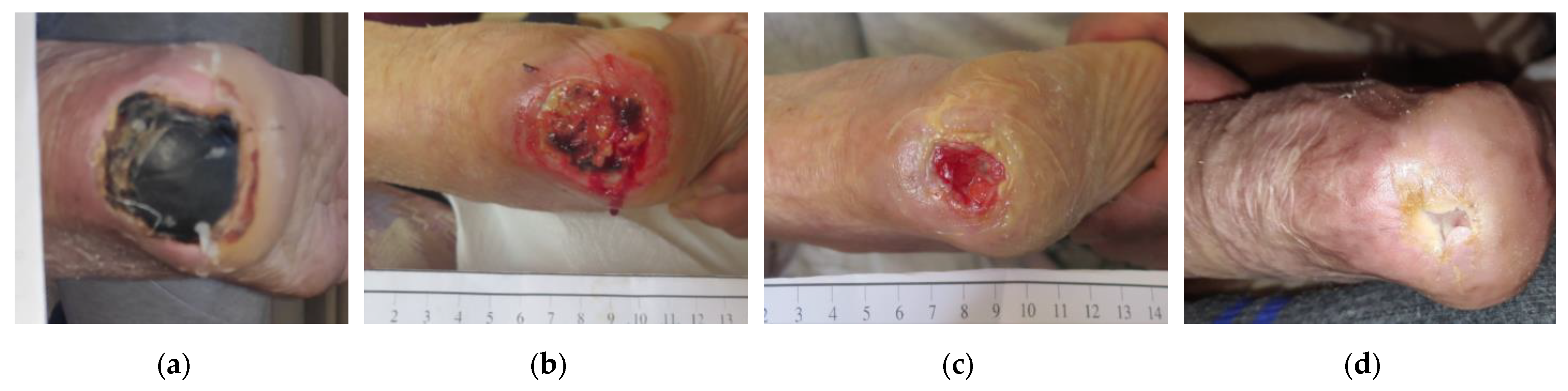 Antibiotics 12 00605 g008 Antibiotics 12 00605 g008
