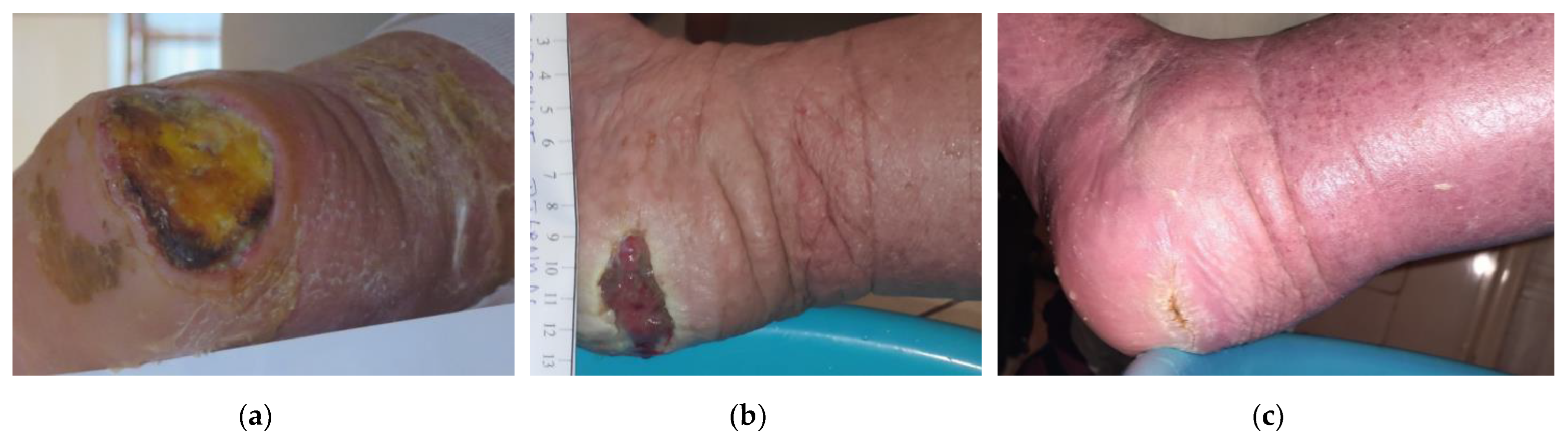 Antibiotics 12 00605 g009 Antibiotics 12 00605 g009