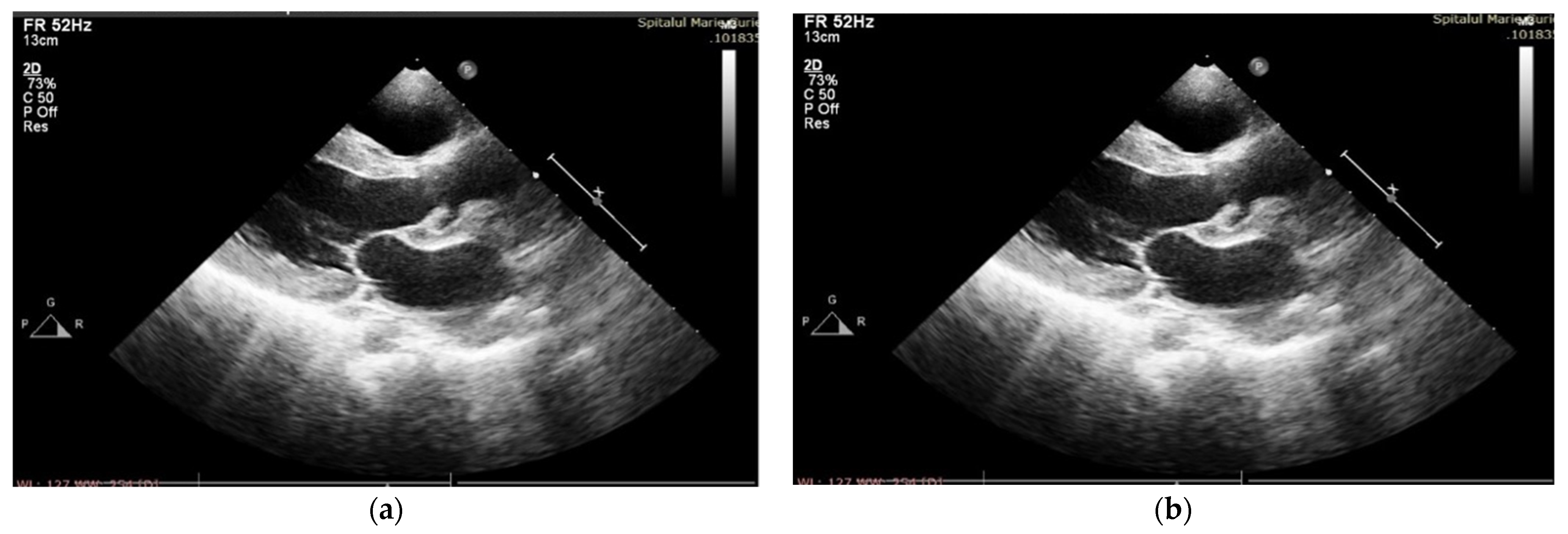 Antibiotics 12 00706 g001