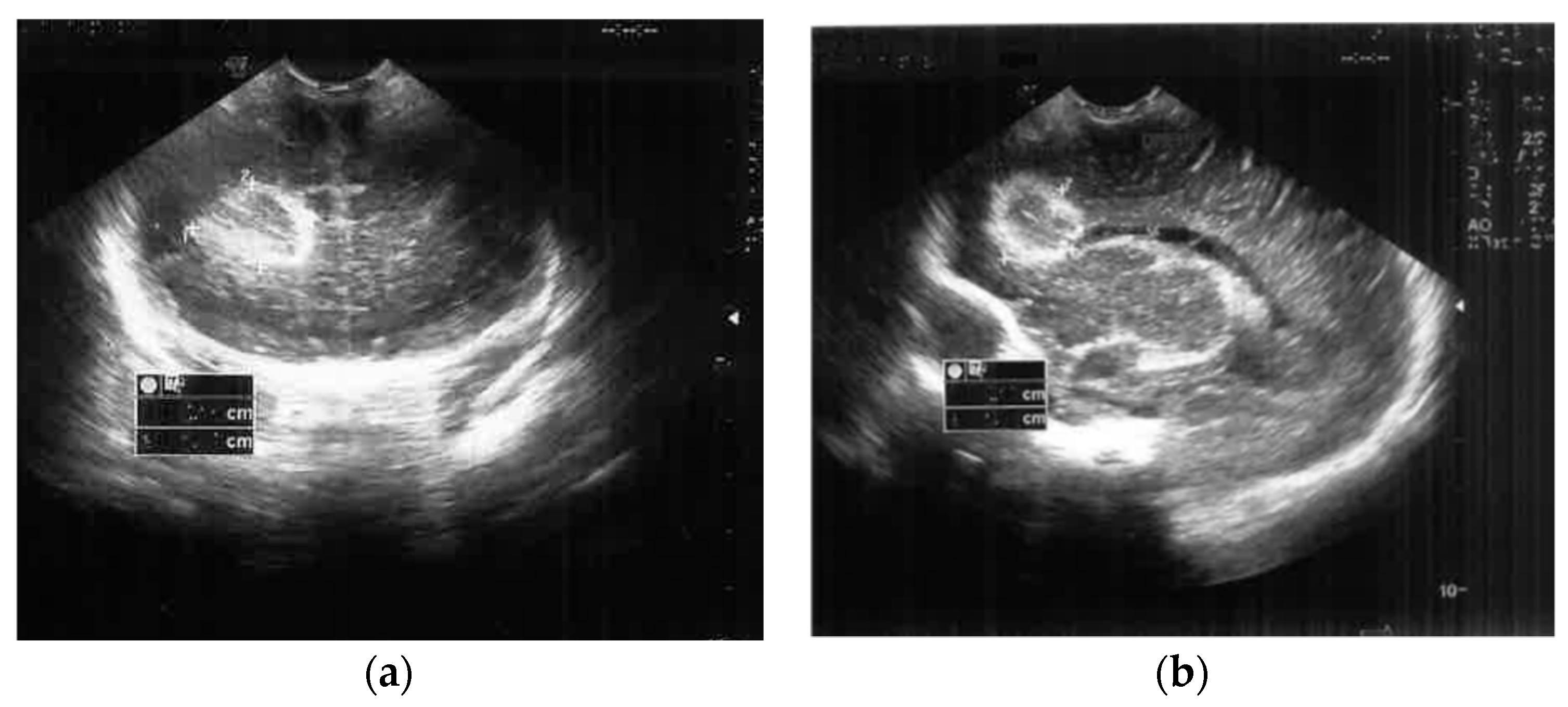 Antibiotics 12 00722 g001