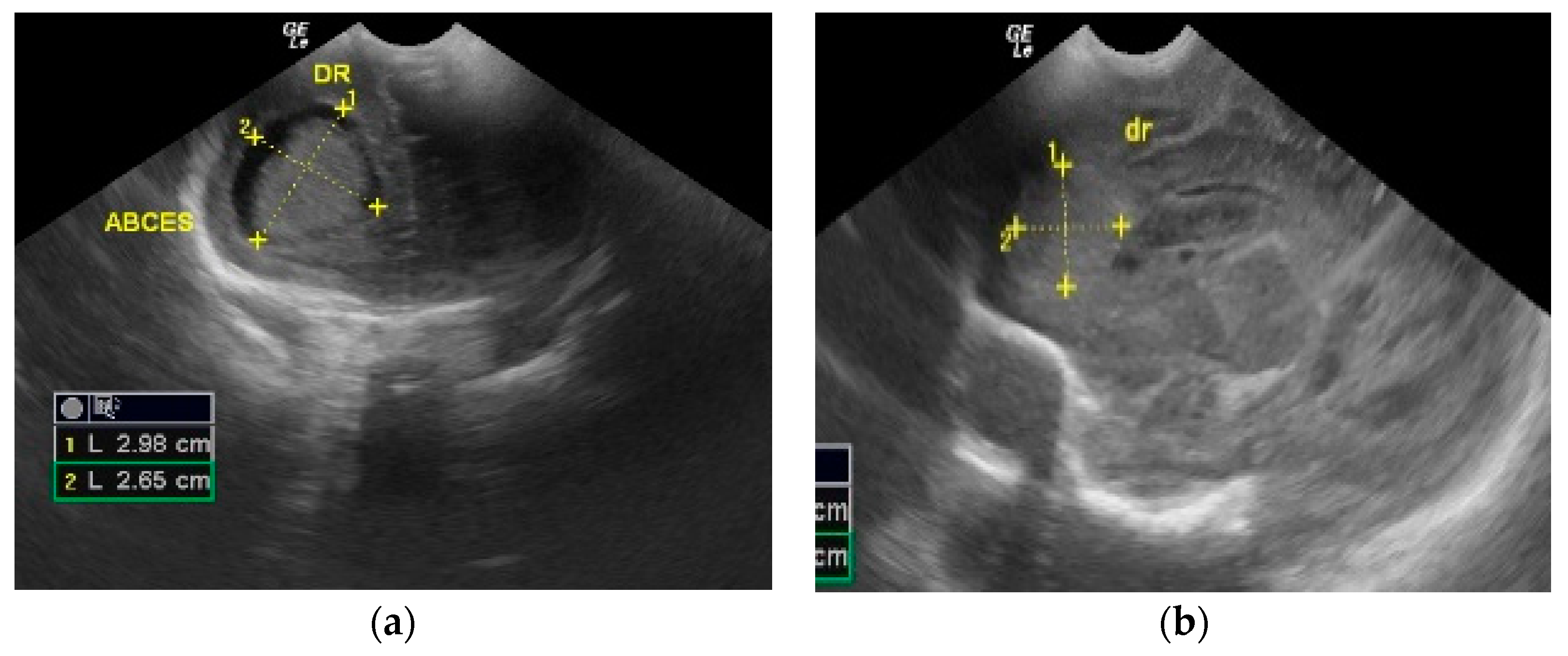 Antibiotics 12 00722 g002